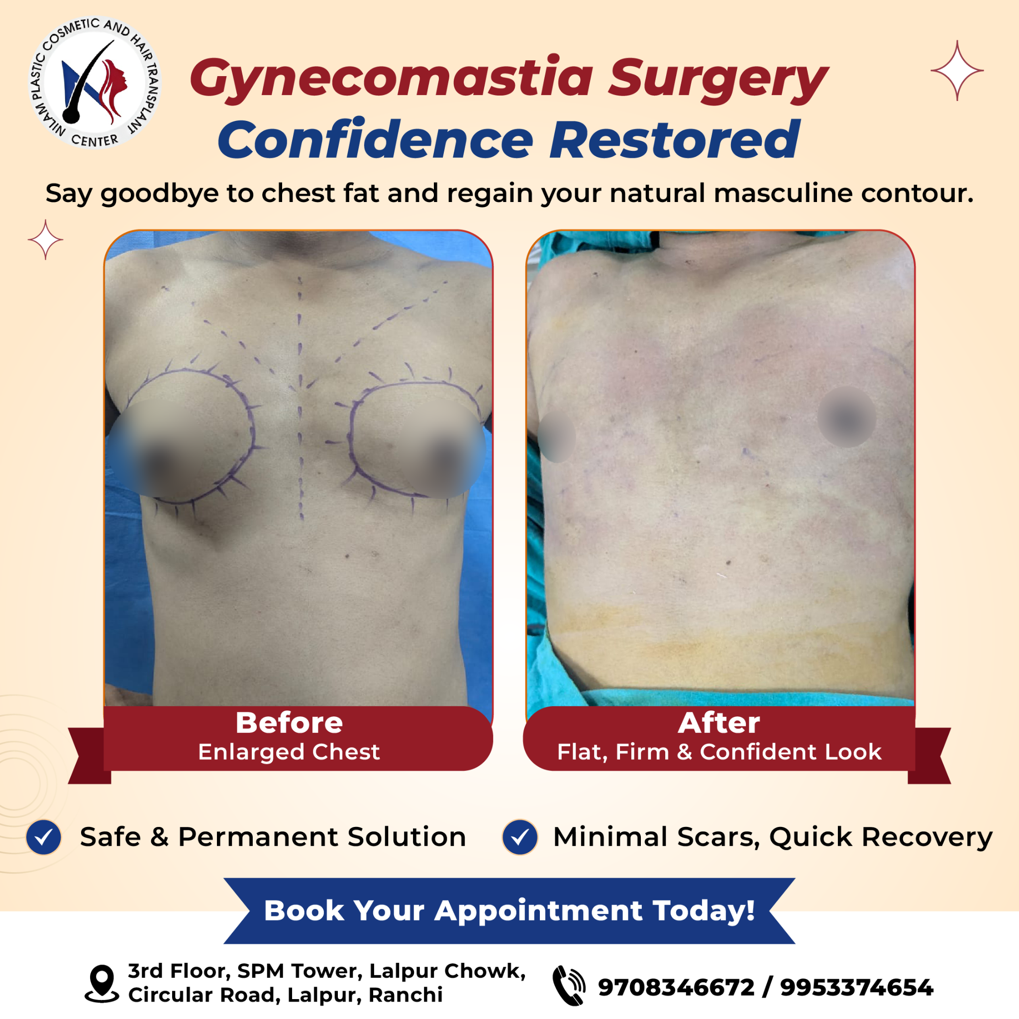 Nilam Plastic and Cosmetic Clinic Facebook ad: FREE Doctor Consultation