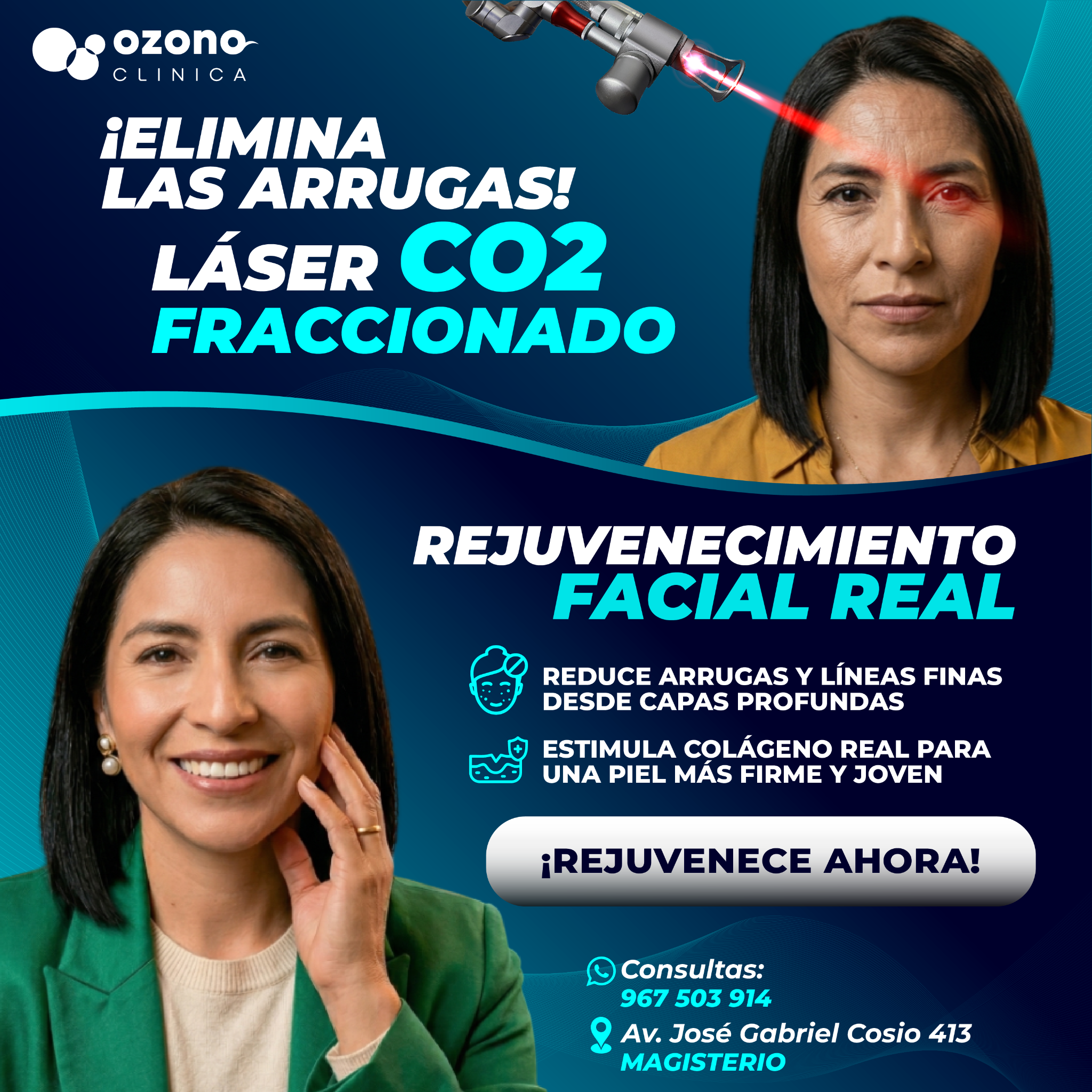 Ozonolaser Facebook ad: NO ES CUIDADO… ES REGENERACIÓN.
