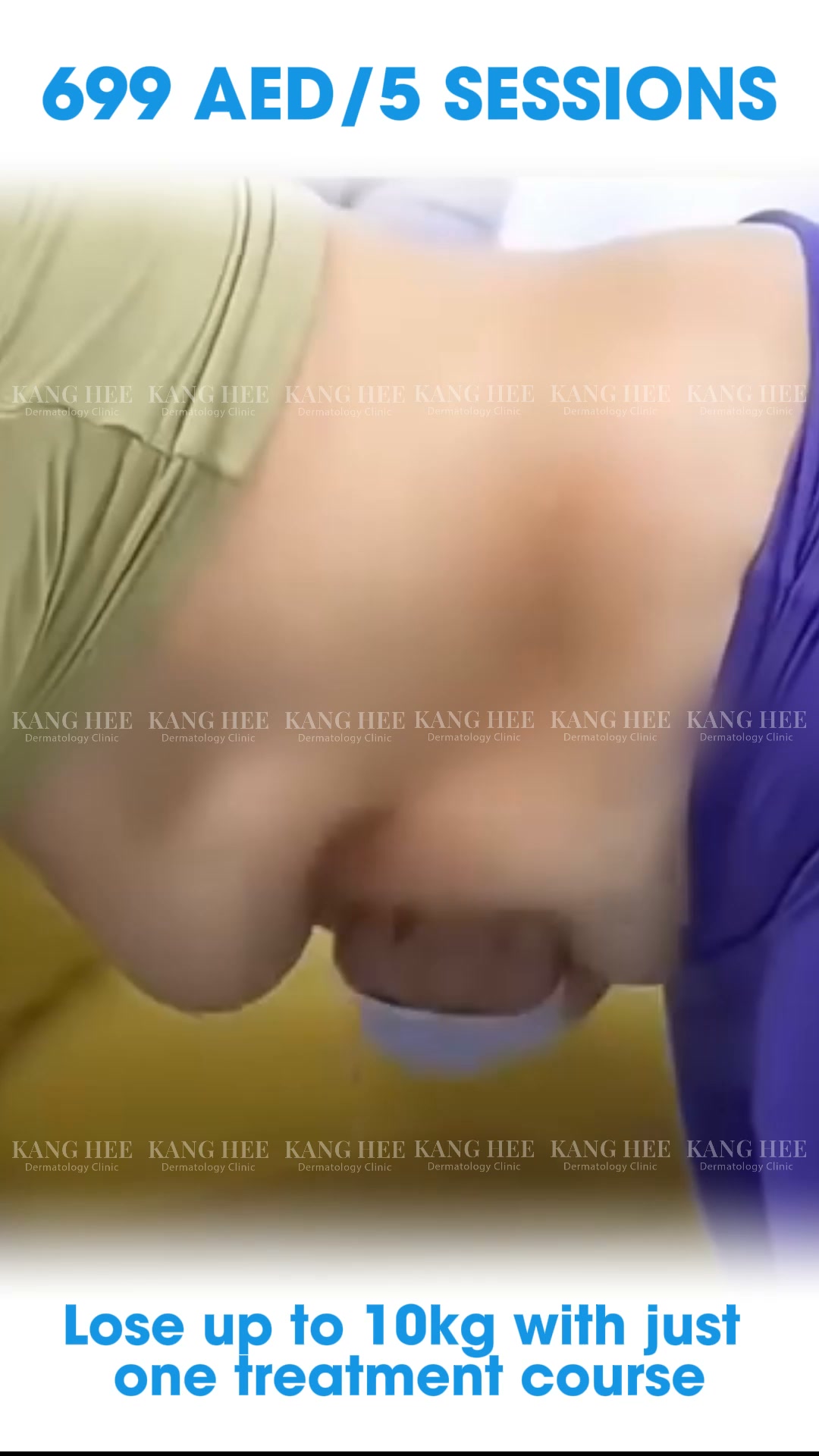 Kanghee Luxury International Aesthetic Institute Facebook ad: LOSE 10-20KG AFTER JUST ONE TREATMENT