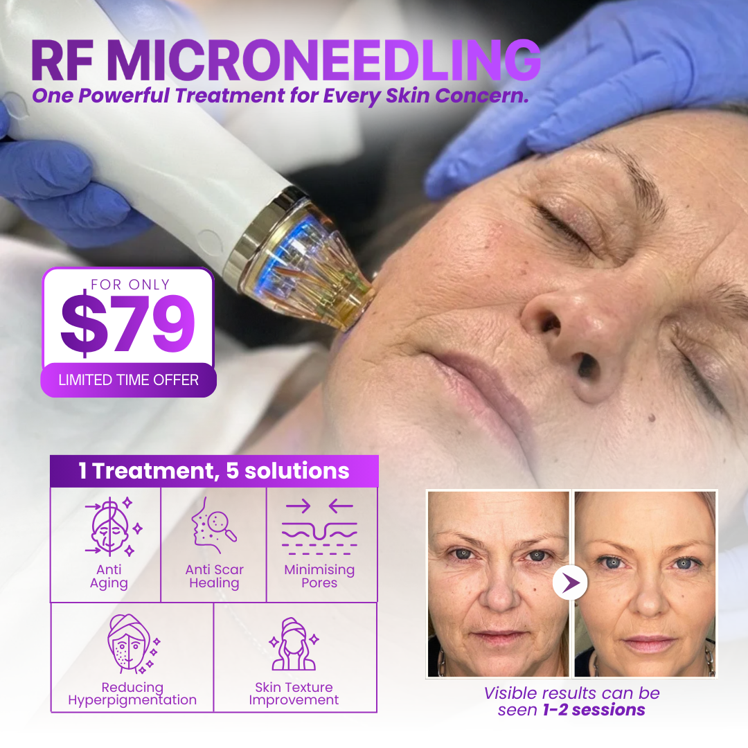 I Love Skin Treatments Facebook ad