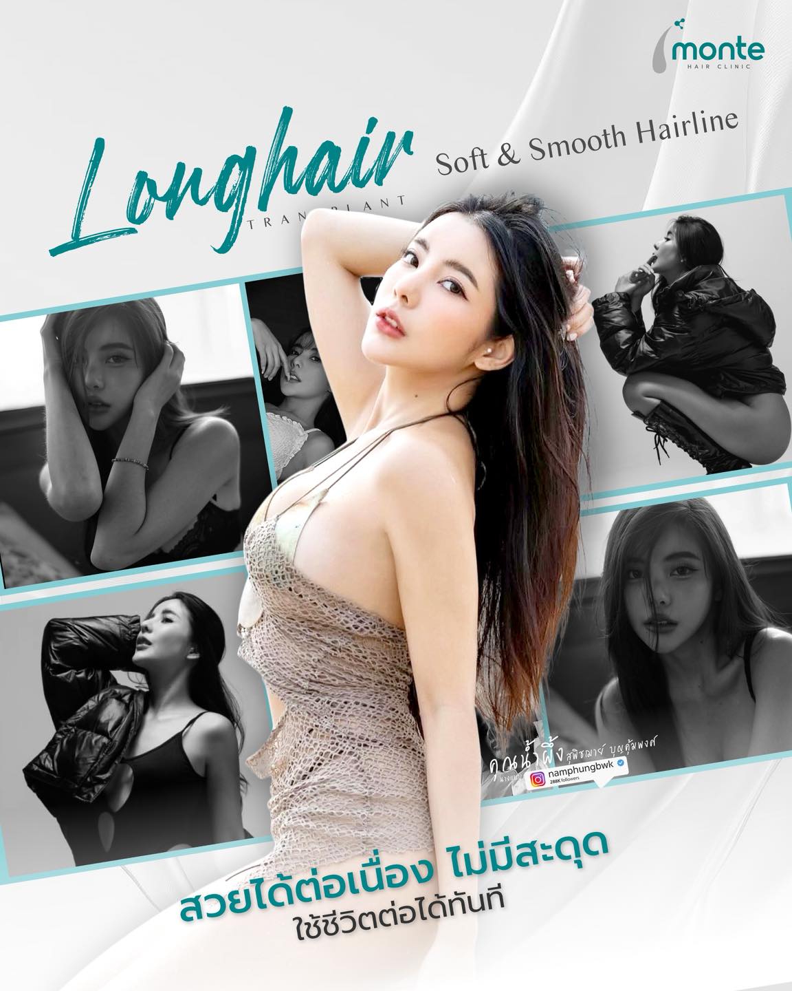 Monte Clinic - Hair Transplant ปลูกผมถาวร คิ้ว หนวดเครา รักษาผมบาง Facebook ad