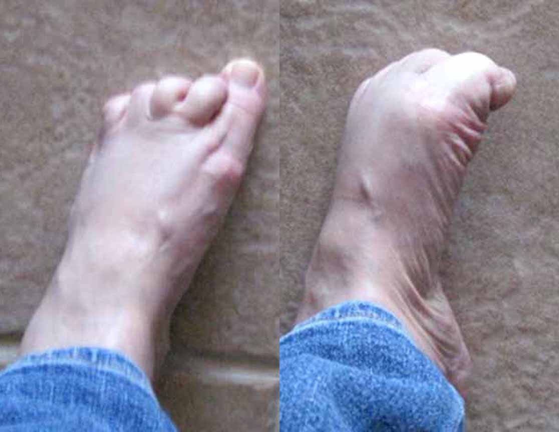 Parkinson Recovery Community Facebook ad