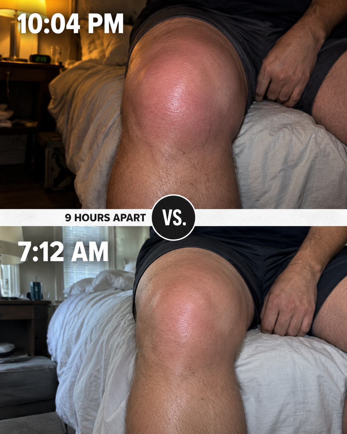 Kathy Miller Facebook ad: 12 years of bone-on-bone knee pain gone in 2 days?