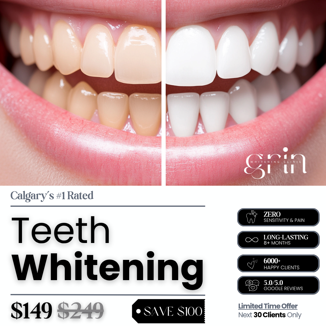 Grin Whitening Clinic Facebook ad: Luxury Teeth Whitening for Just $149 ($100 OFF)
