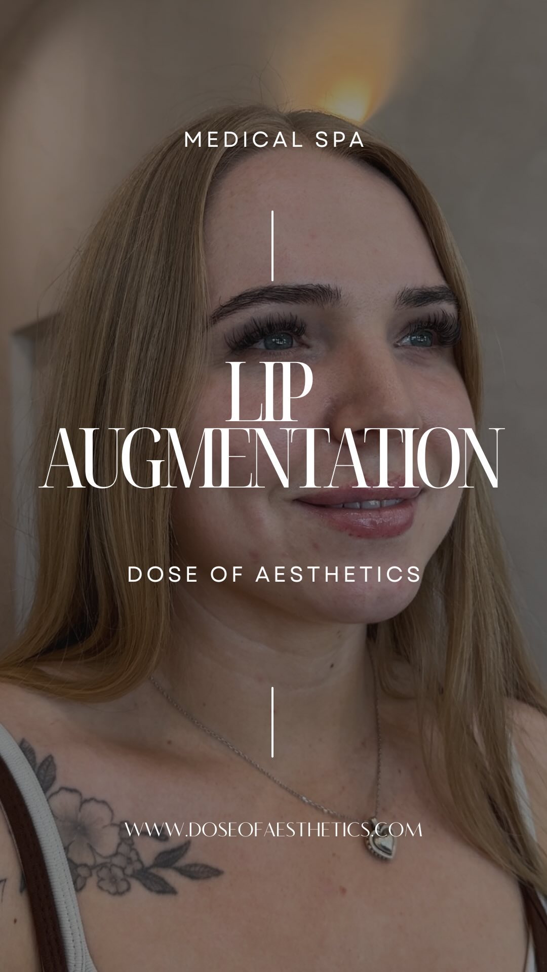 Dose of Aesthetics Medical Spa Facebook ad: DOSE OF AESTHETICS 𝓈𝒾𝑔𝓃𝒶𝓉𝓊𝓇𝑒 LIP AUGMENTATION