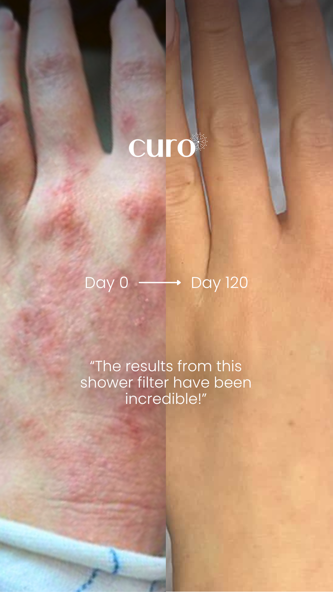 Curo Skin Facebook ad