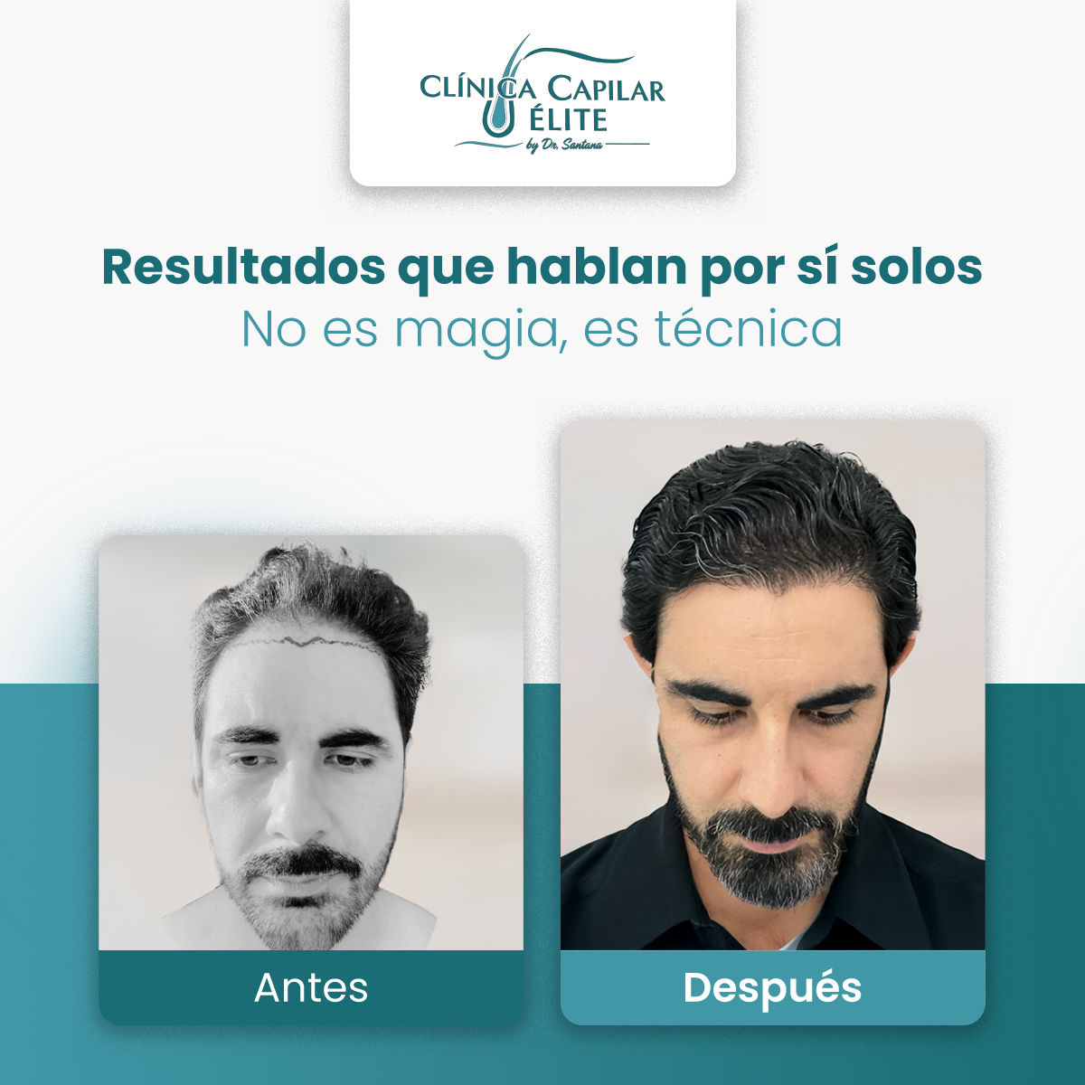 Los Reyes Del Injerto MX Facebook ad: Este podría ser tu próximo cambio