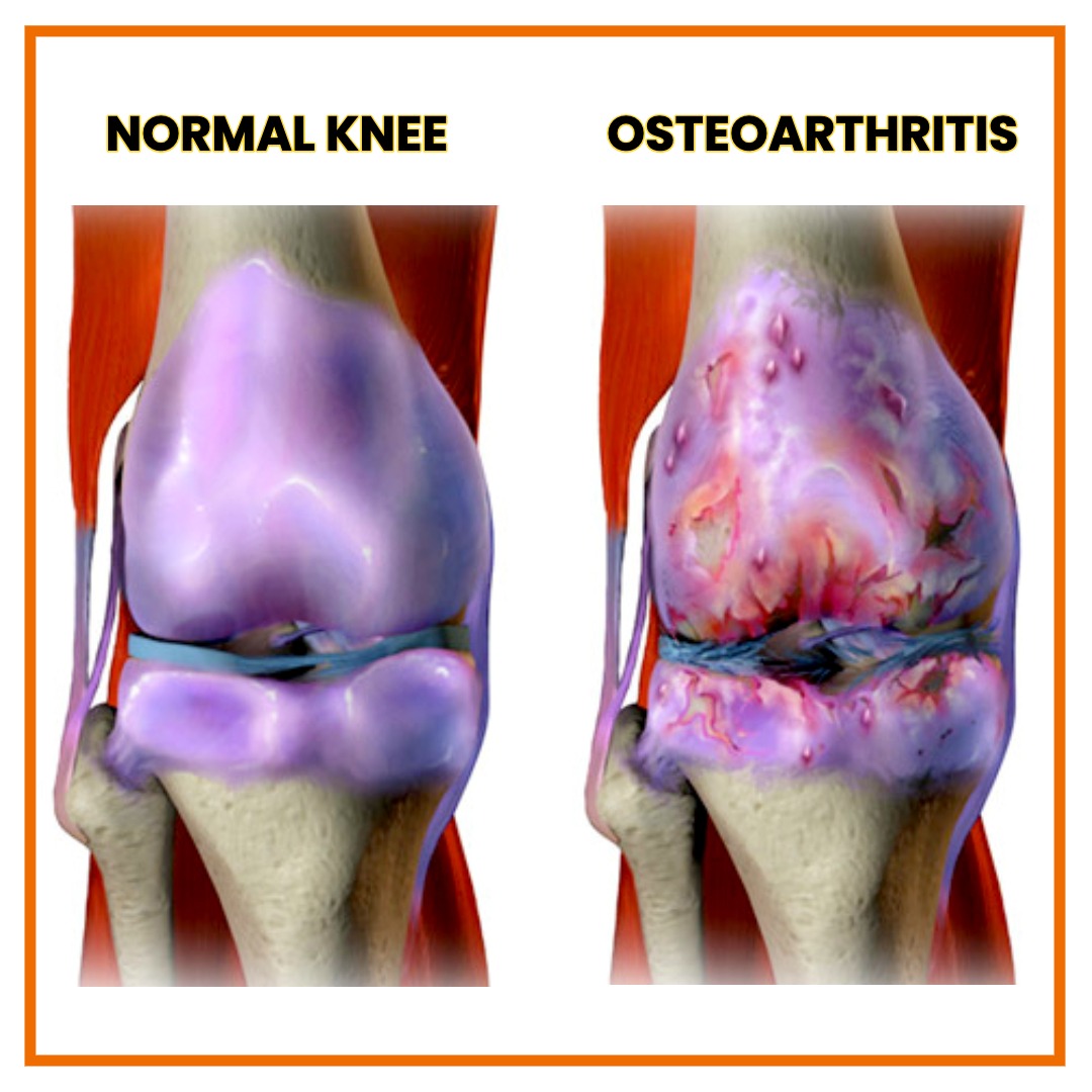 Morningstar Neuropathy & Pain Treatment Center Facebook ad