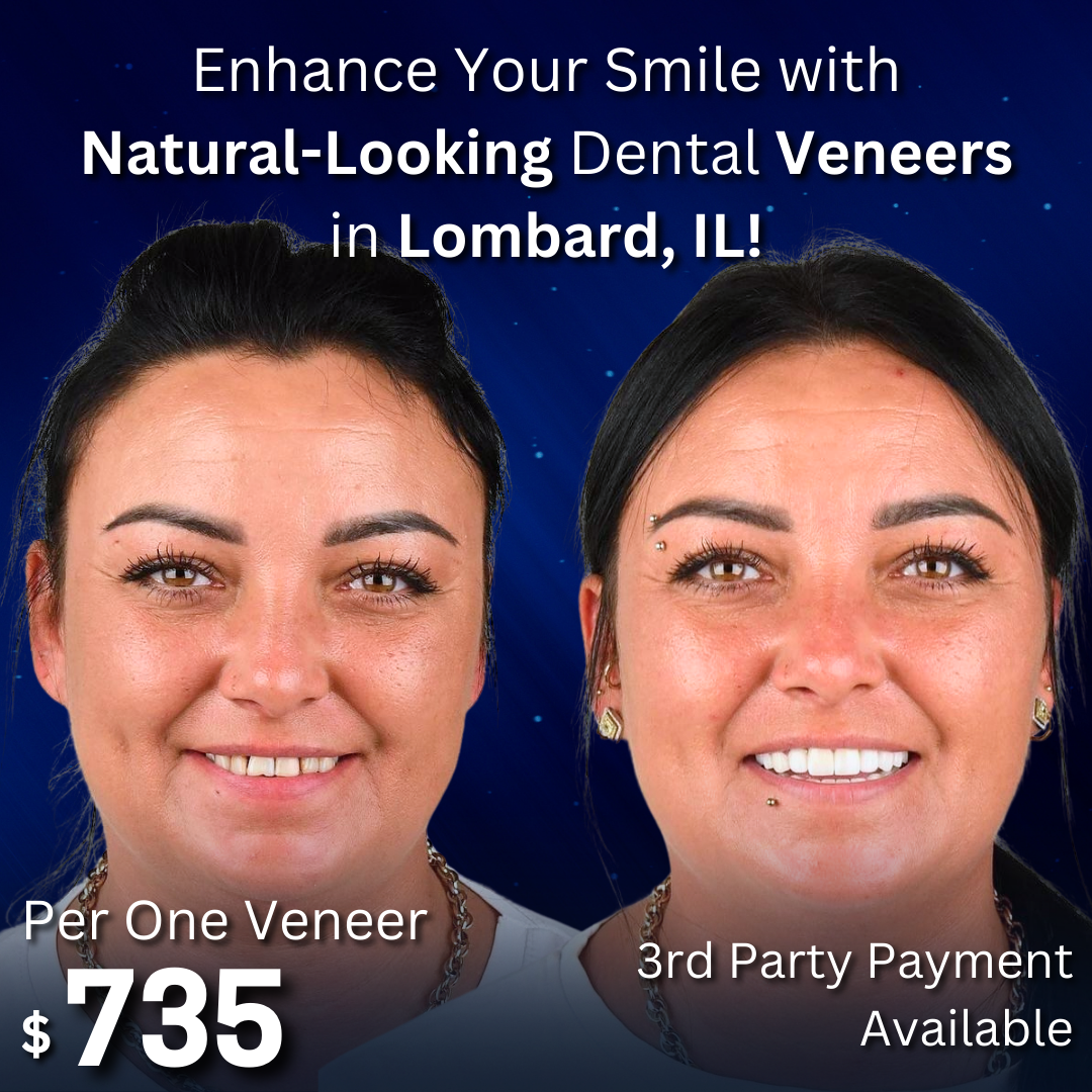 Lead Dental Facebook ad