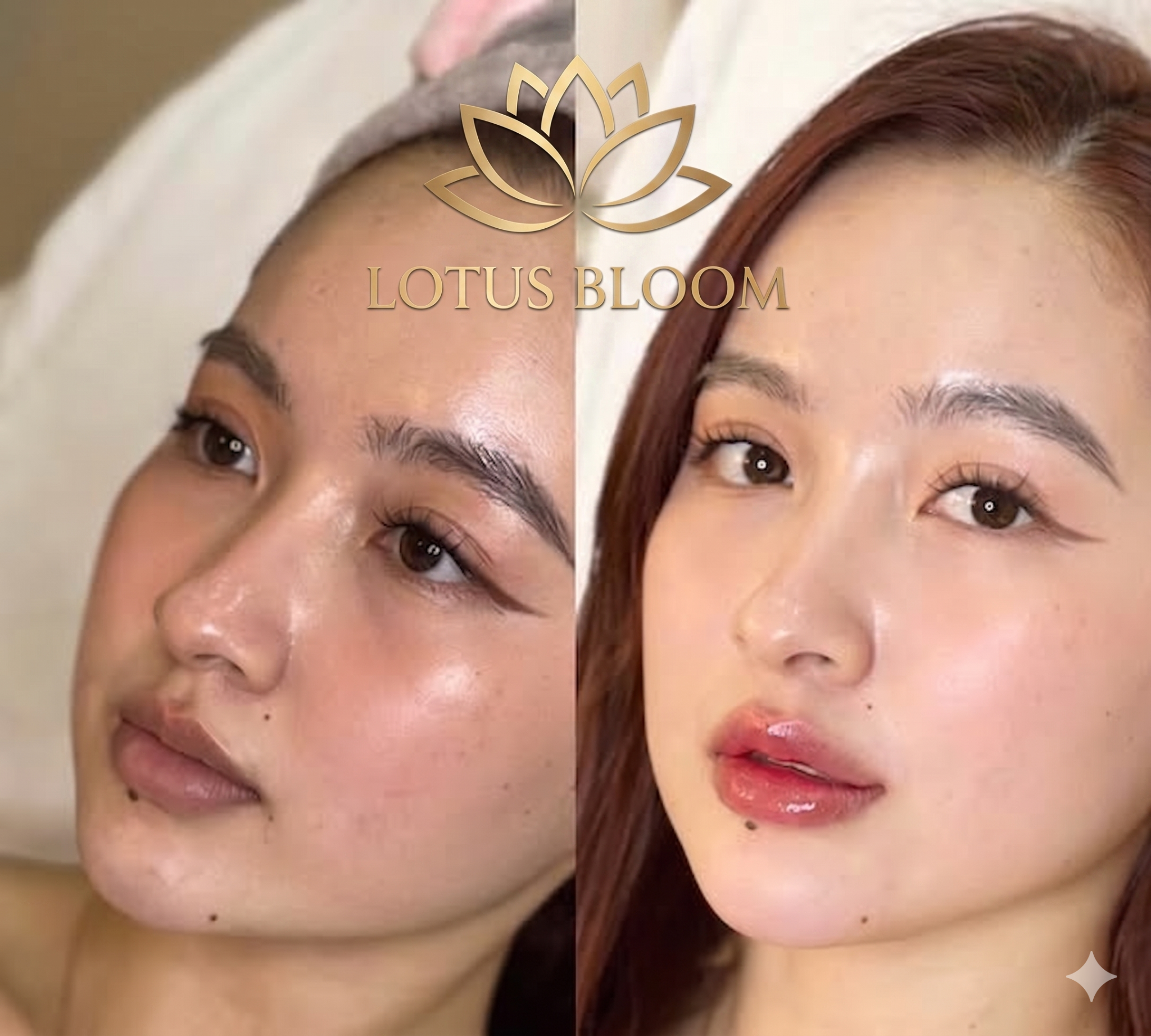 Lotus Bloom Beauty Facebook ad: 100% EVERYONE GETS A GIFT! Free door gifts worth up to 259…