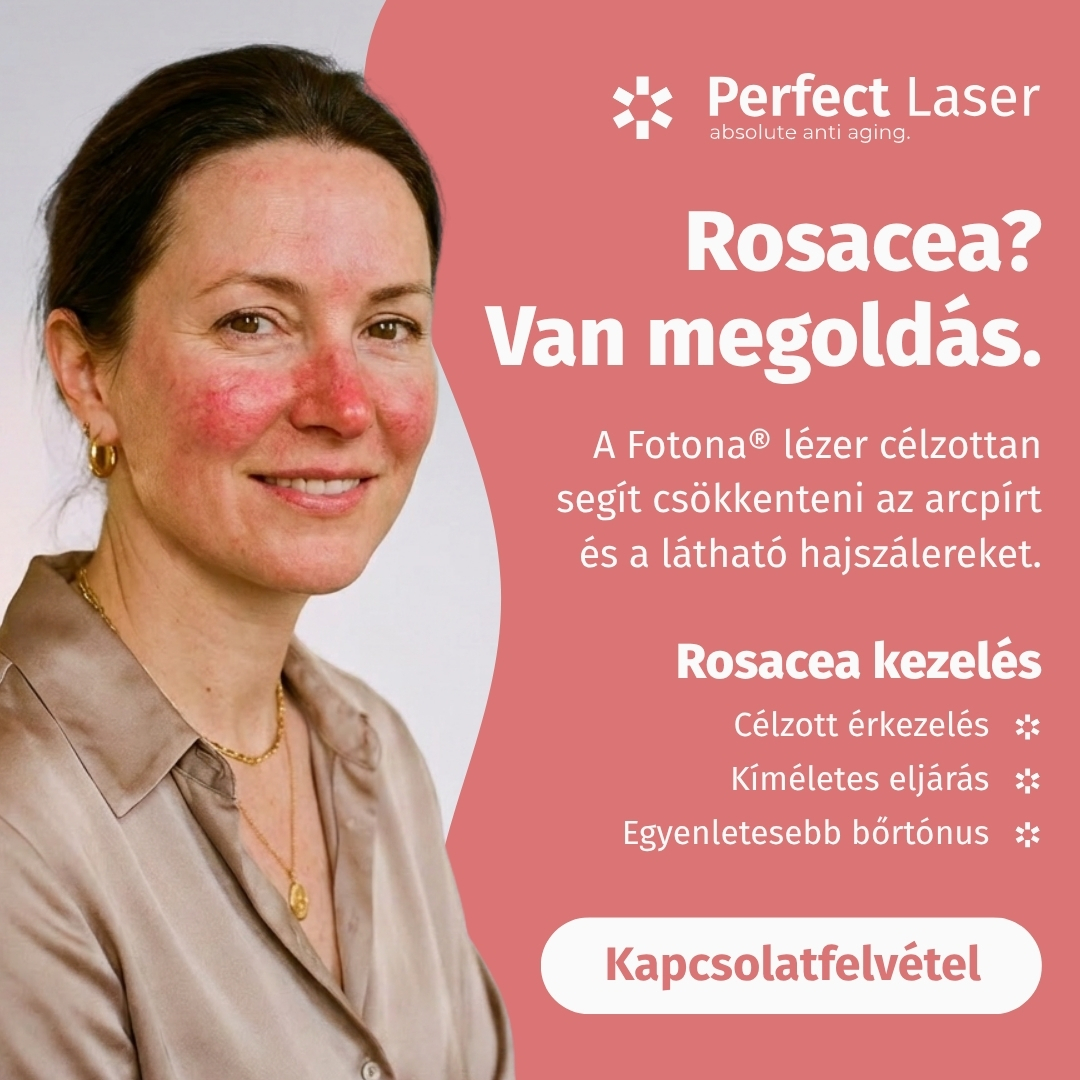Perfect LASER Facebook ad