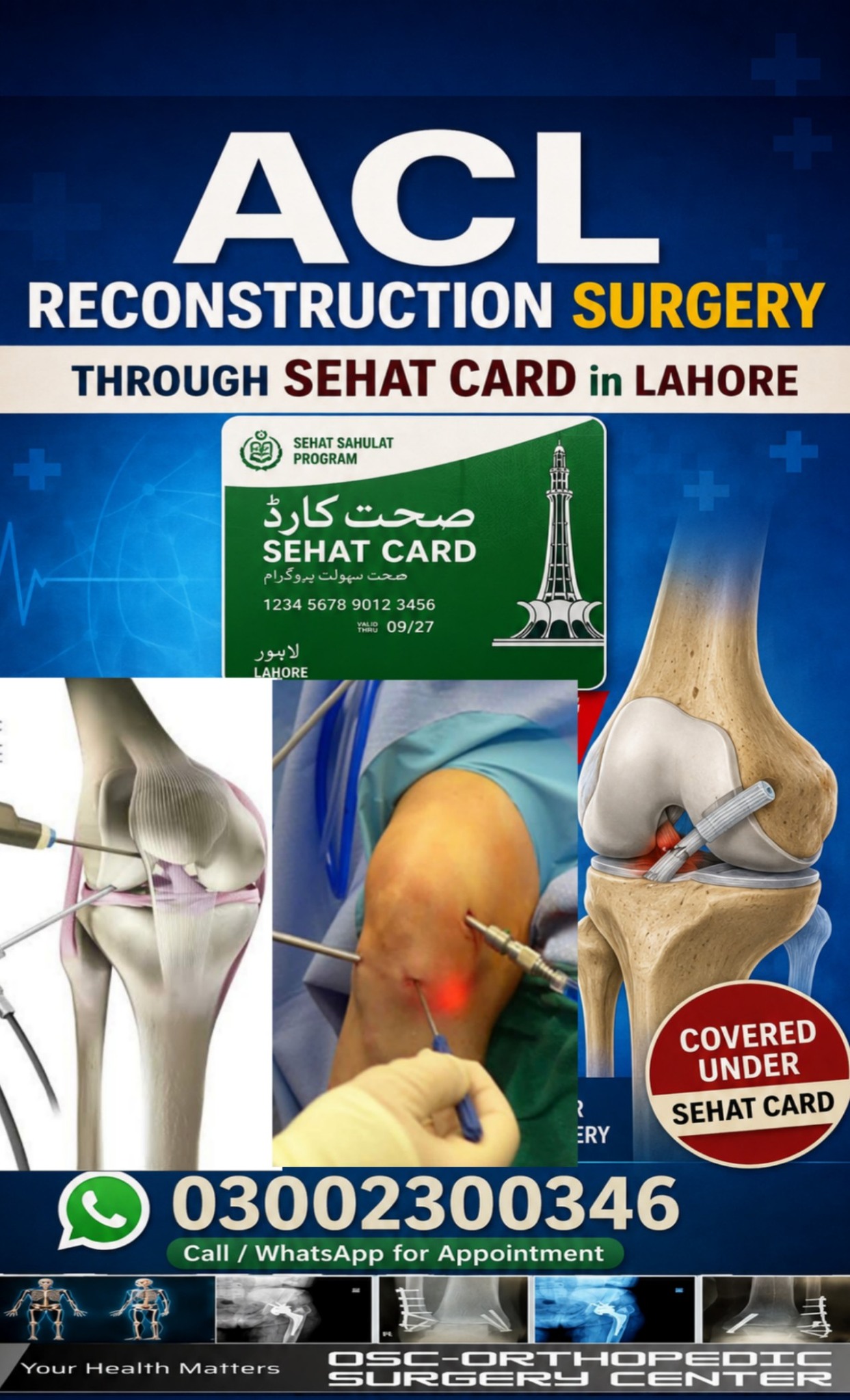 OSC-Orthopedic Surgery Center Facebook ad: ACL Surgery Through Sehat Card in Lahore
