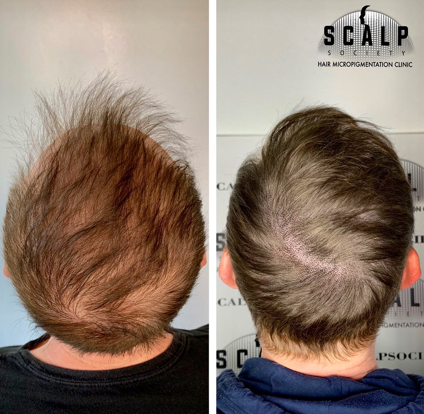 Scalp Society - Scalp Micropigmentation Clinic Facebook ad