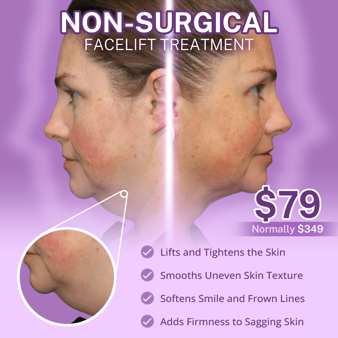 I Love Skin Treatments Facebook ad