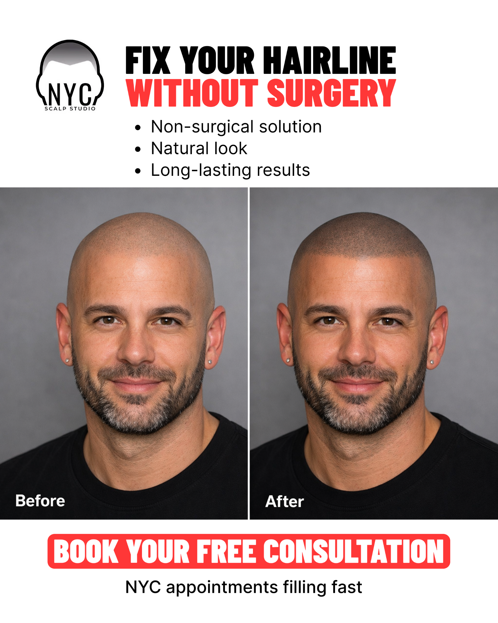 NYC Scalp Studio Facebook ad: Fix Your Hairline Without Surgery