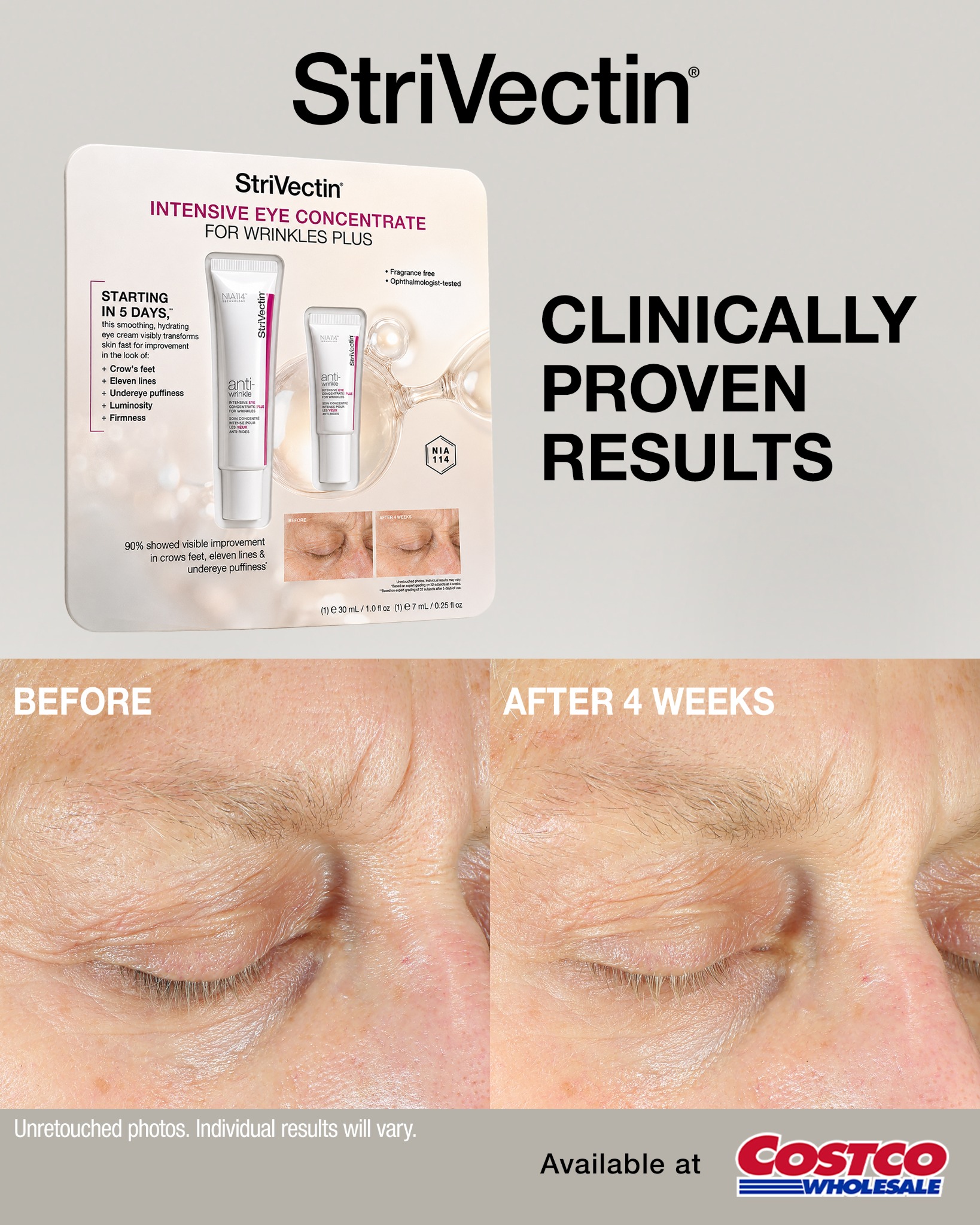 StriVectin Facebook ad
