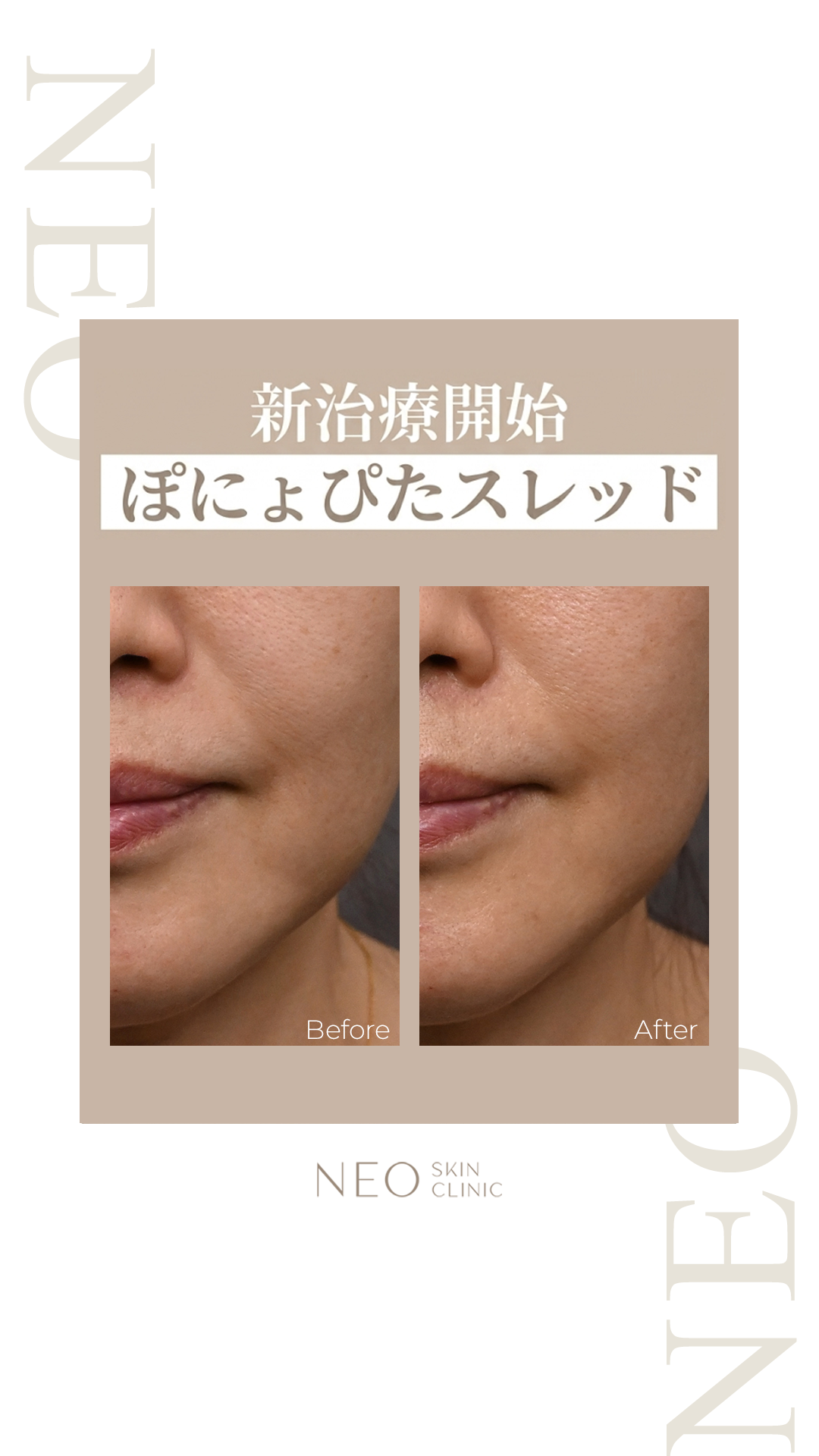 NEO Skin Clinic Facebook ad