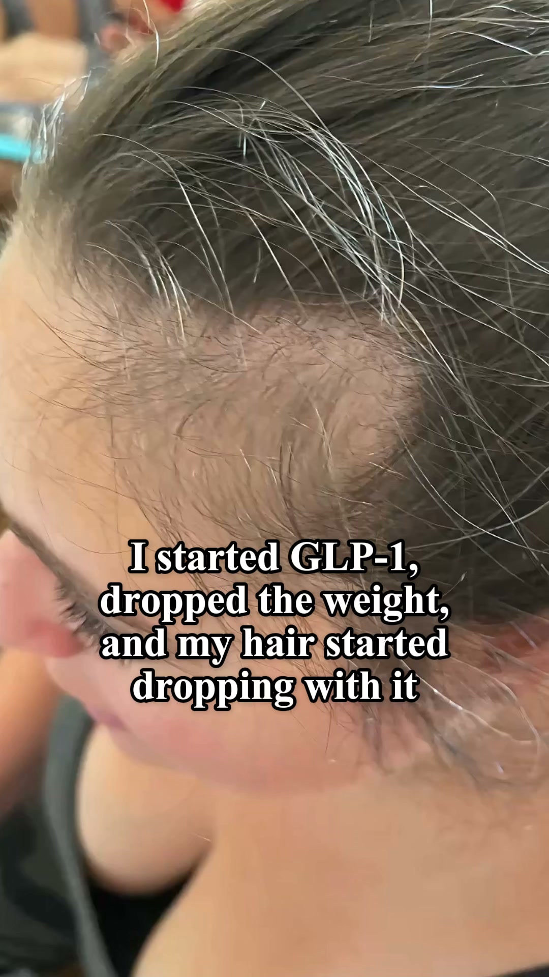Bloom & Bond Facebook ad: Help Hair Loss Naturally