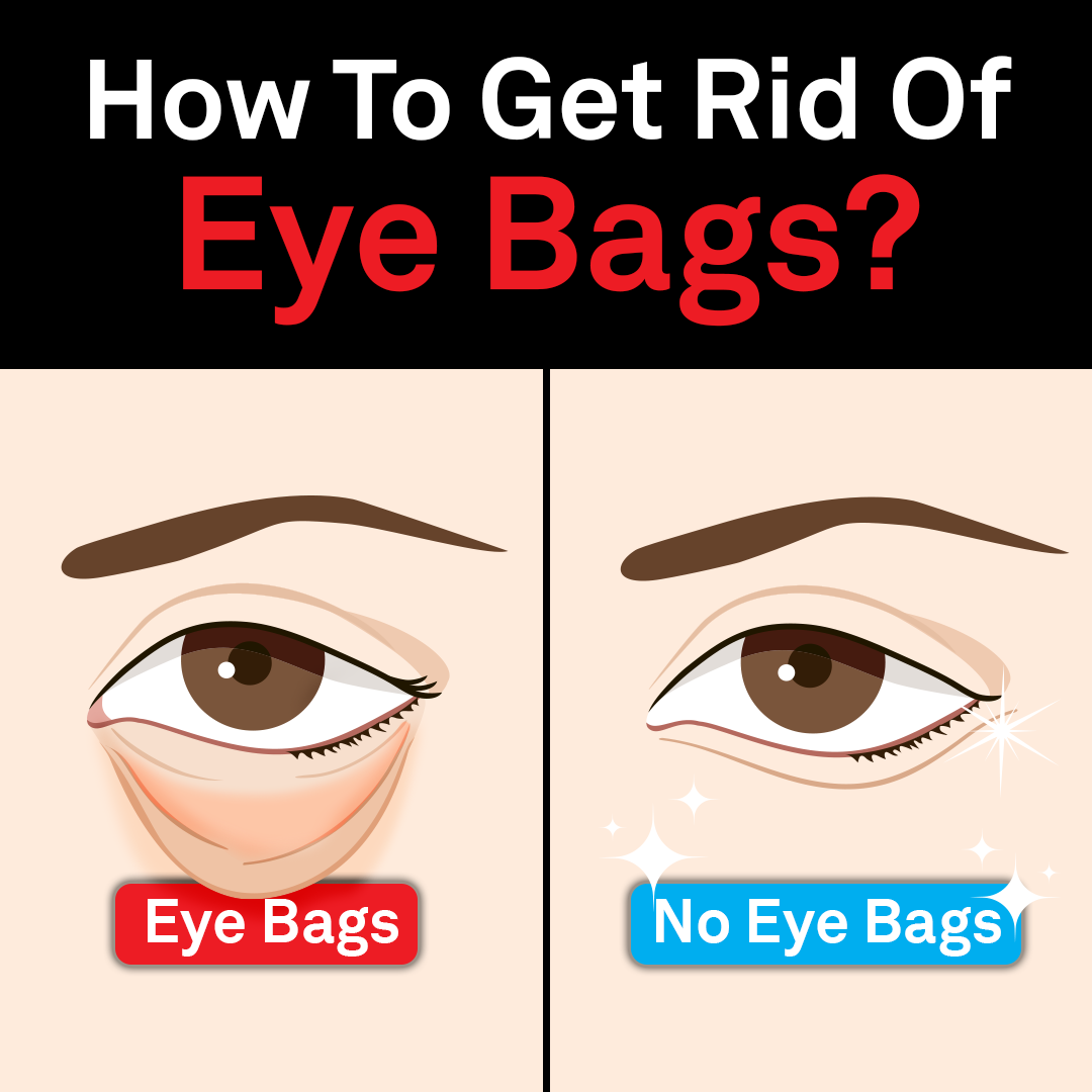 Cyabags 5th & Glow Facebook ad: Eyebags Gone Within Minutes, Never Coming Back