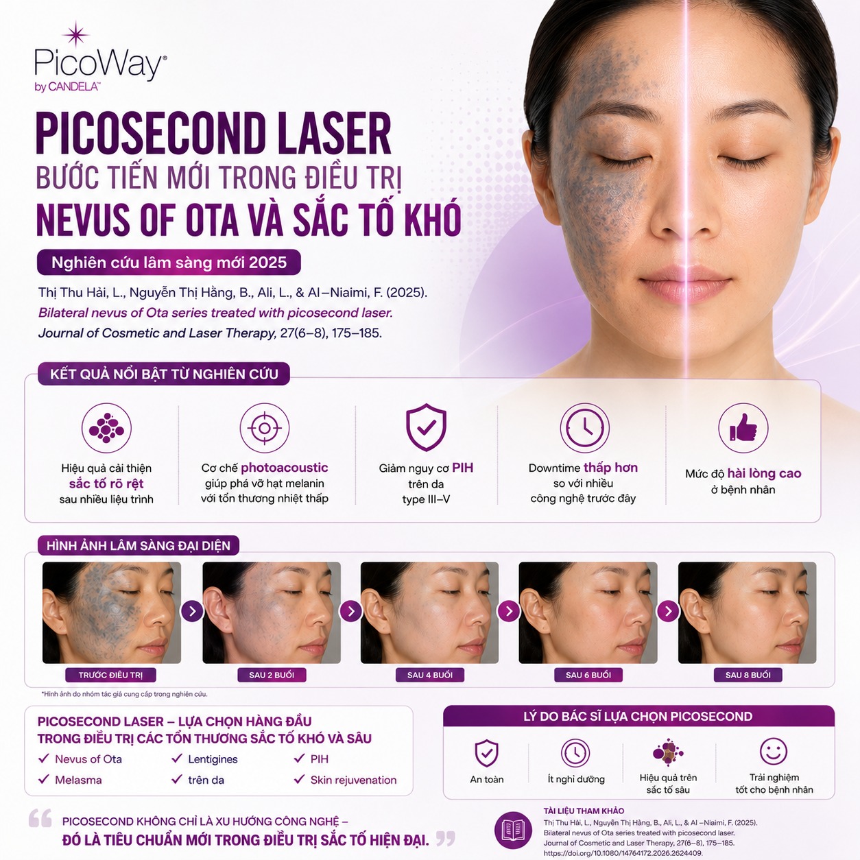 Vinson Laser Facebook ad: Các Bệnh viện, phòng khám sử dụng máy Laser Picoway chính…