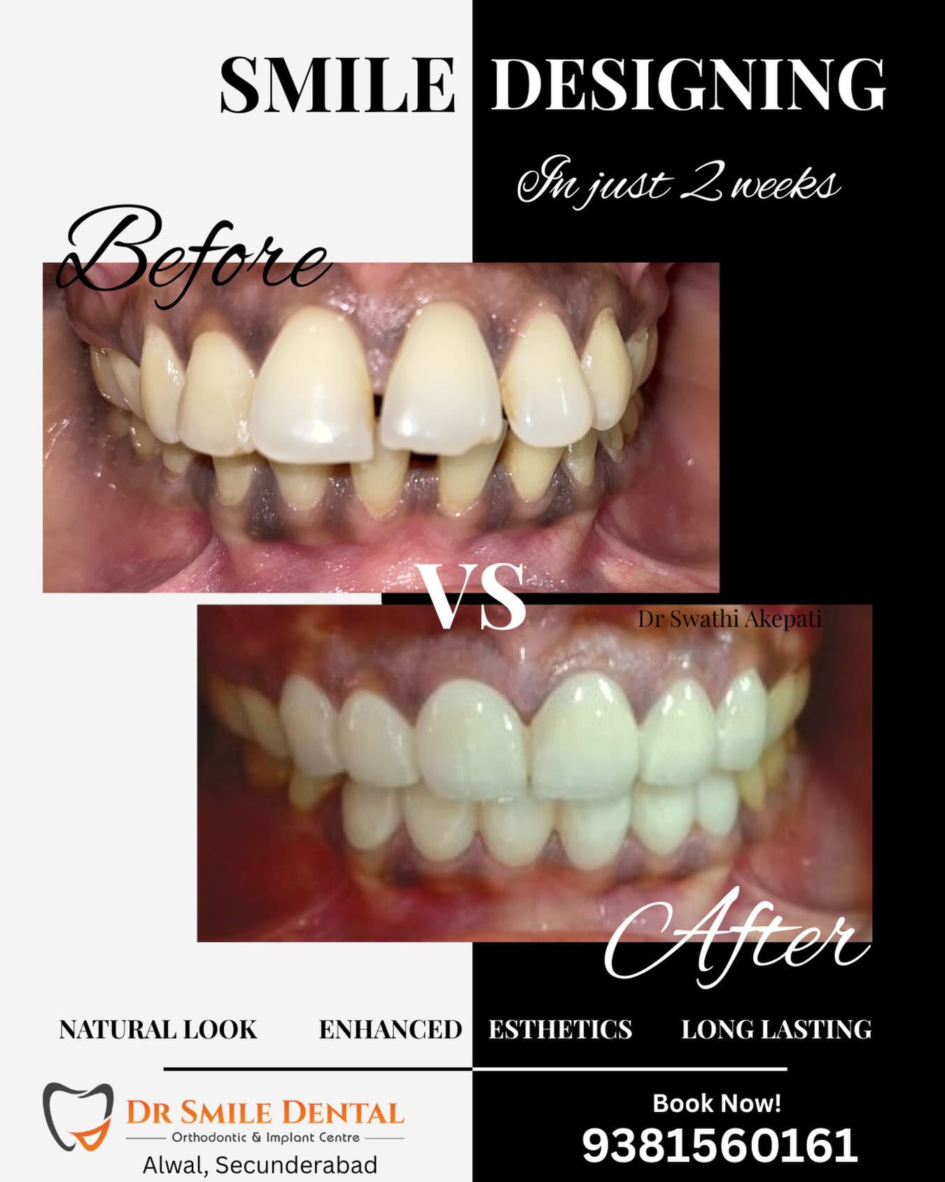 Dr Smile Dental Facebook ad: She dreamed of a smile she could confidently…