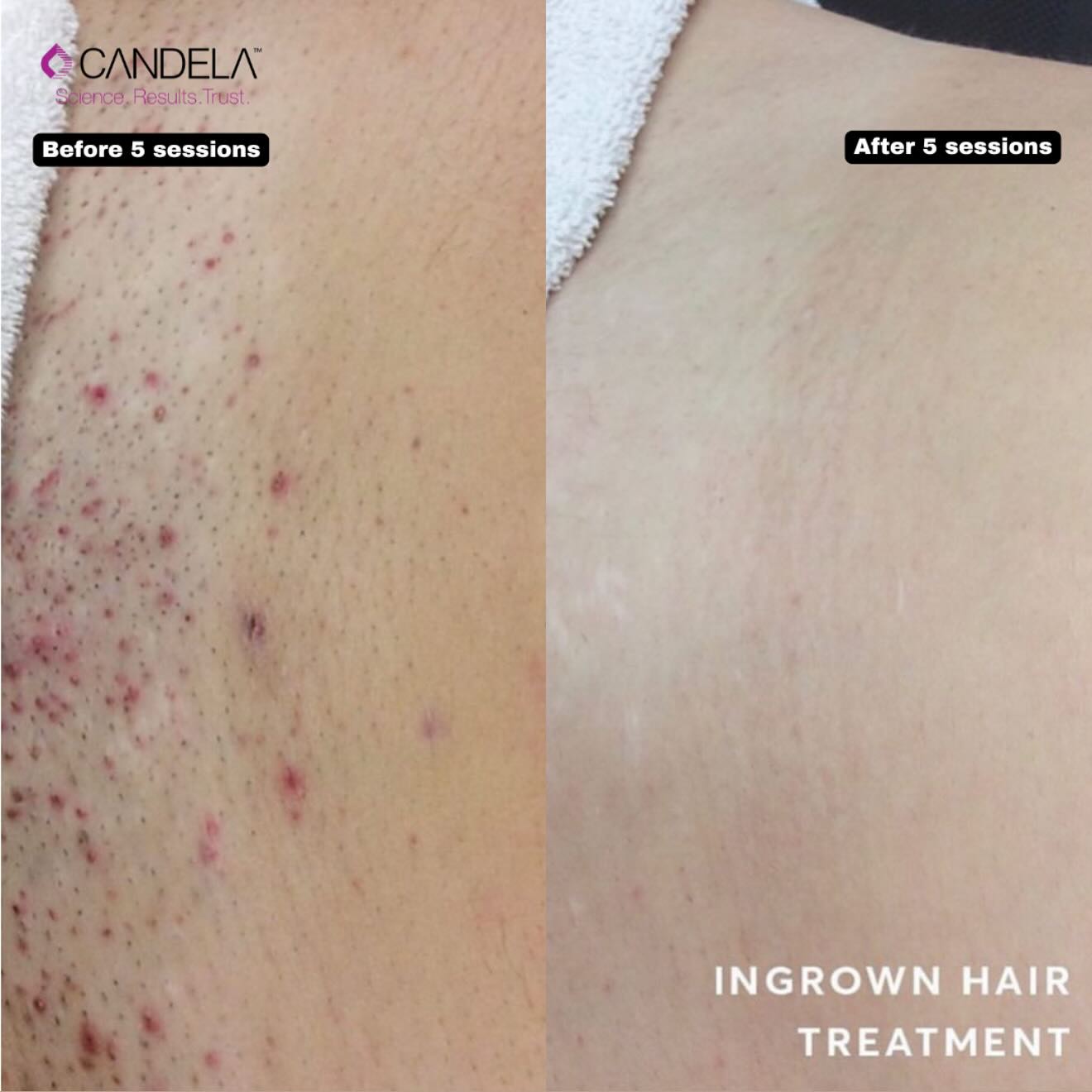 Skin And Laser Haus Facebook ad