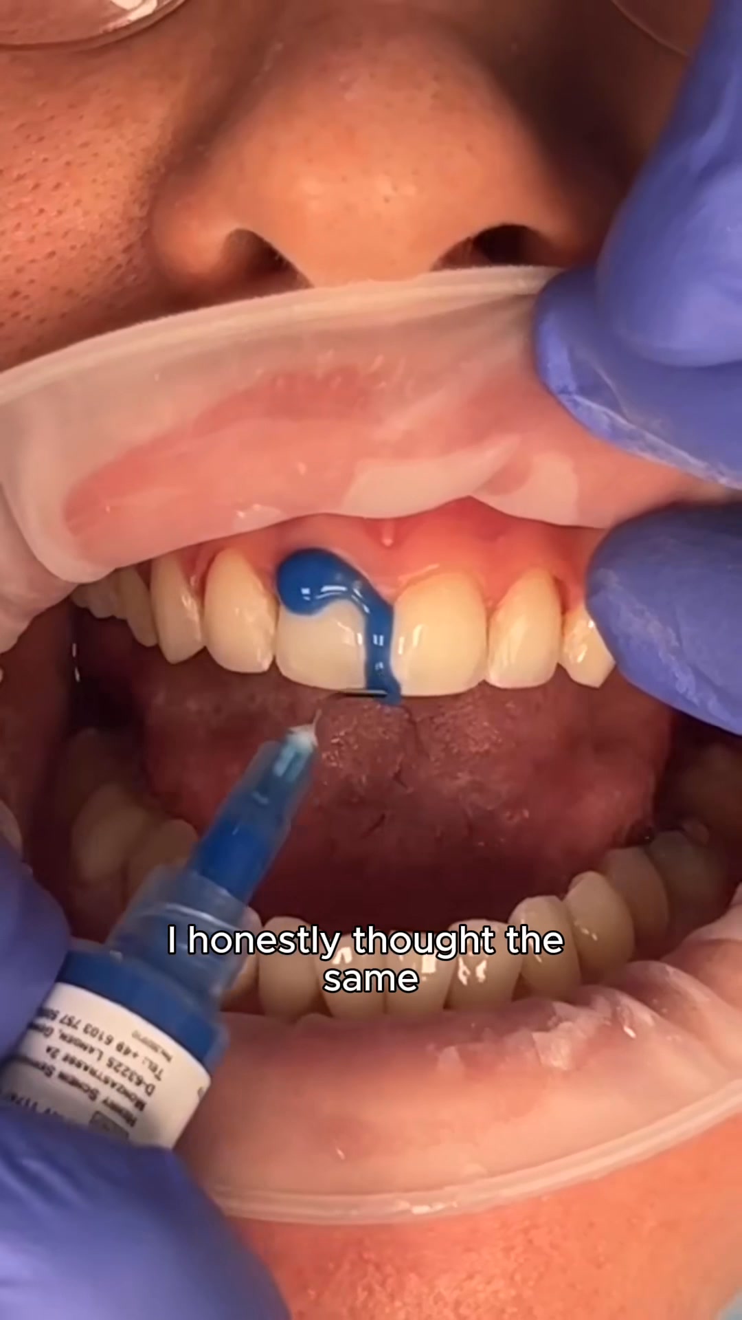 Oral Health Tips Facebook ad: This Tiny Jar Made Me Stop Hiding My Smile