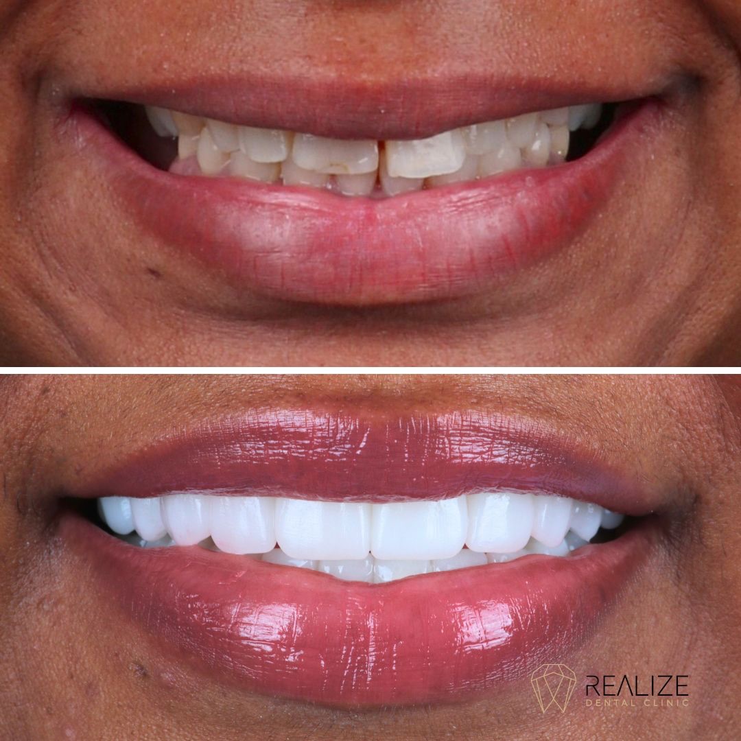 Realize Dental Clinic Facebook ad: A paciente apresentava problemas dentários e havia…