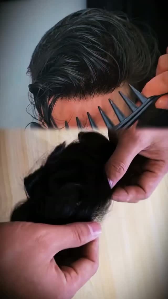 Yalla Hair - Hair Patch Fixing & Hair Replacement Centre Facebook ad: Experiencing hair loss or thinning can quietly drain…