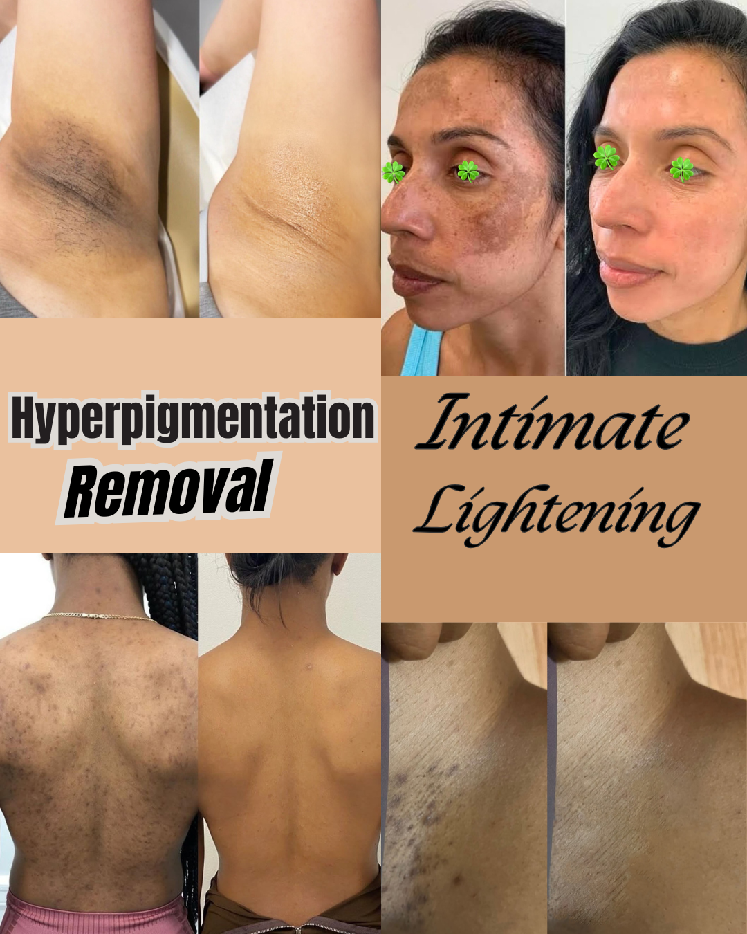 Cloverderm Facebook ad: Hyperpigmentation