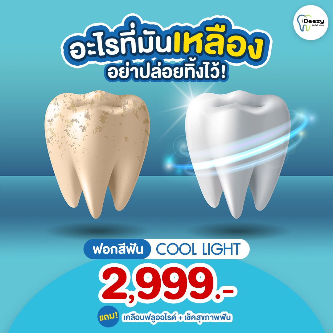 Deezy Dental Home คลินิกทันตกรรม อุบลฯ อุดรฯ ขอนแก่น Facebook ad
