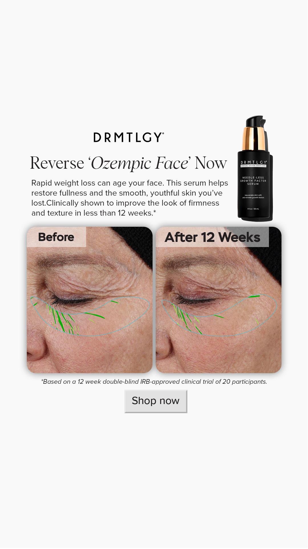 DRMTLGY Facebook ad