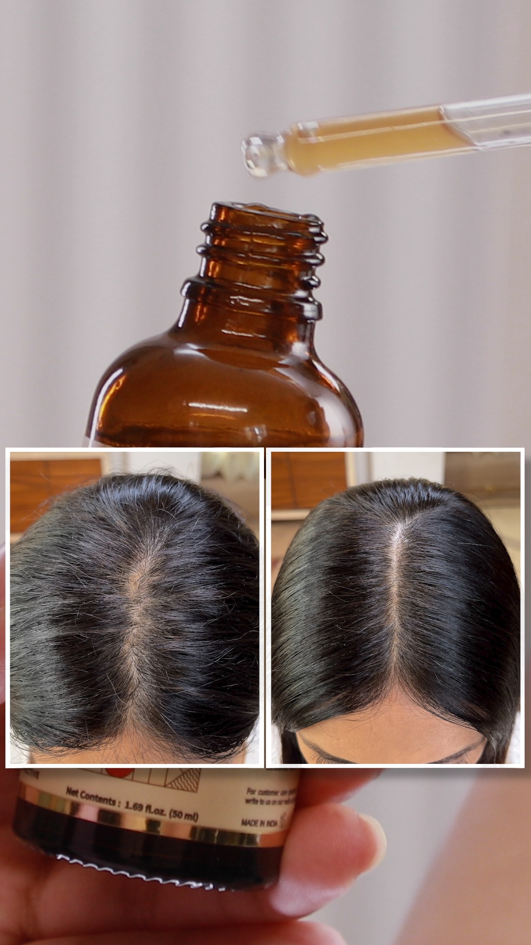 the_vinny_verse Facebook ad: World’s No.1 Customised Ayurvedic Hair Care- Shop Vedix Now!