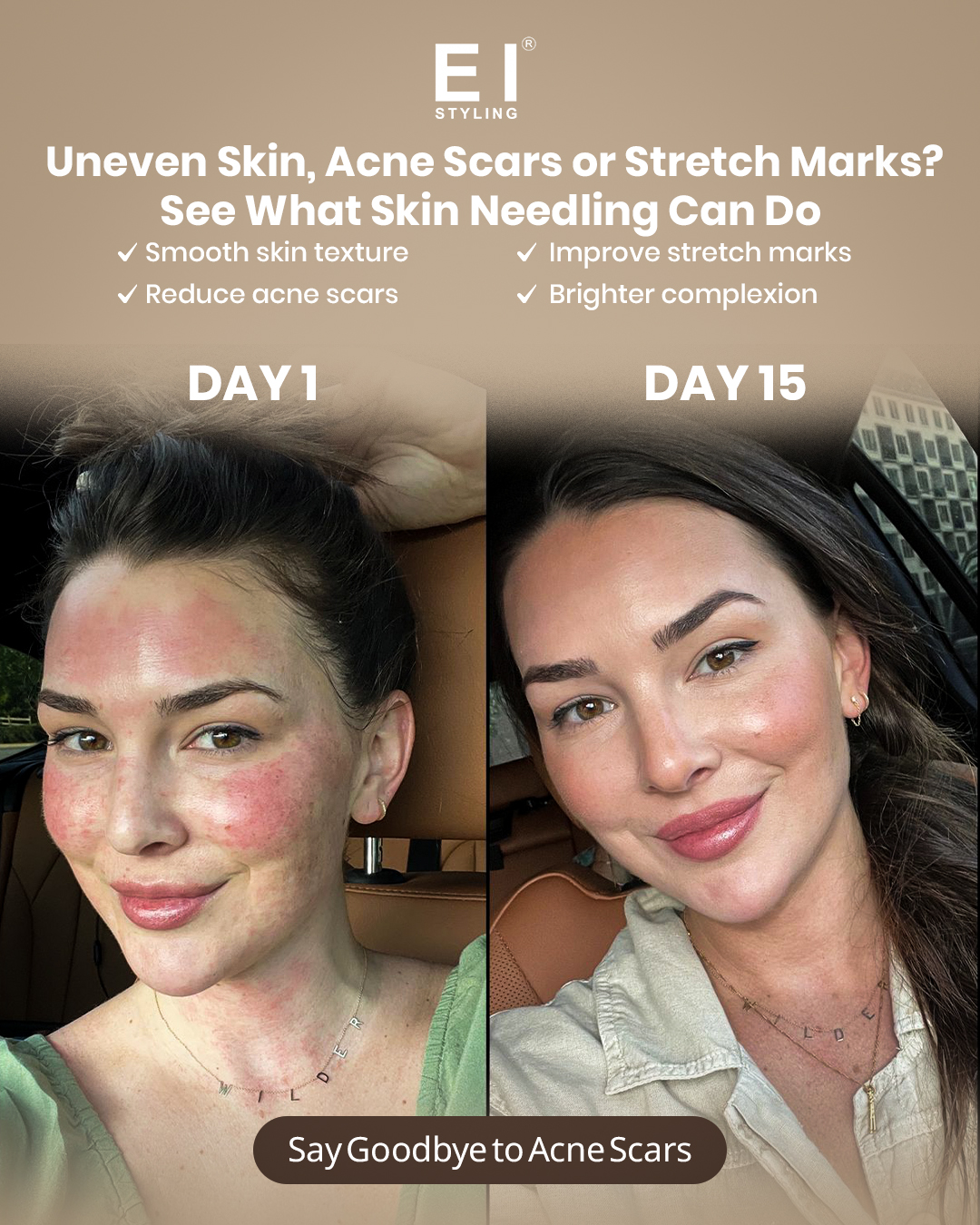 Eyebrow Ink Styling Facebook ad: See The Difference: Skin Needling