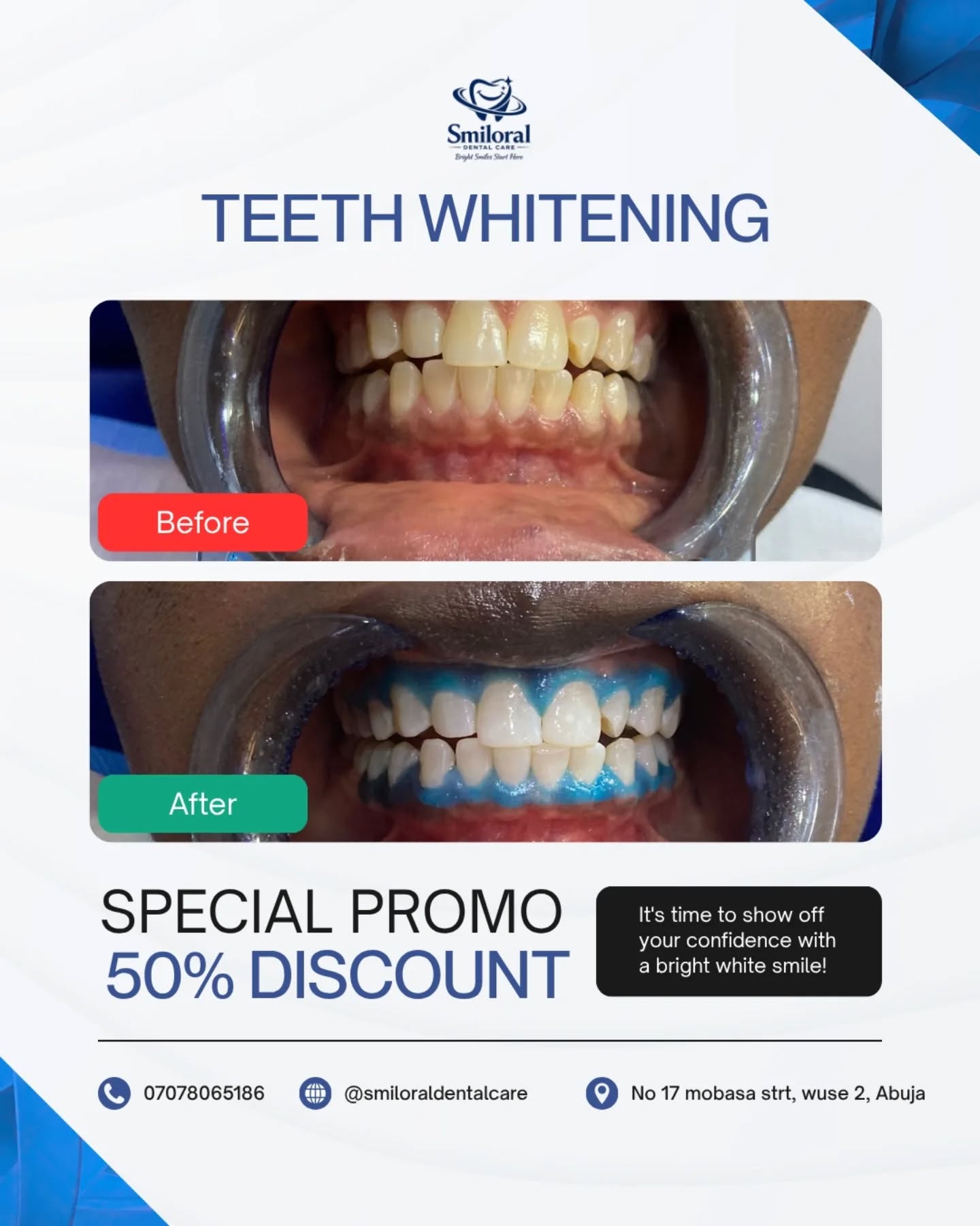 Smiloral Dental Care Facebook ad: Tired of hiding your smile?