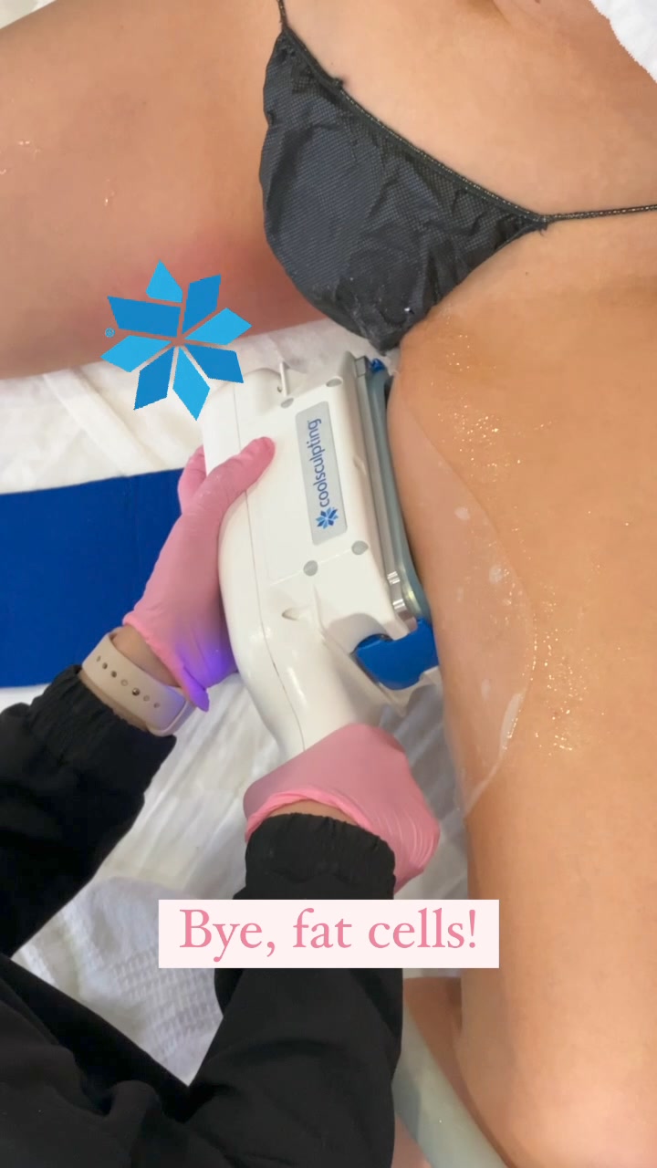 LaserAway Facebook ad: CoolSculpting Fat Reduction