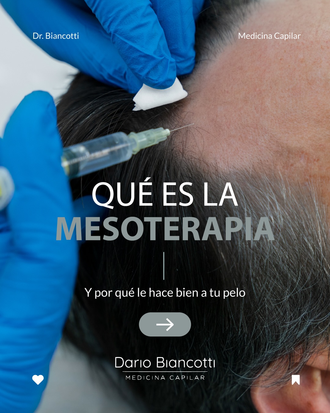 Biancotti Medicina Capilar Facebook ad: Mesoterapia capilar: nutrición que actúa desde la raíz