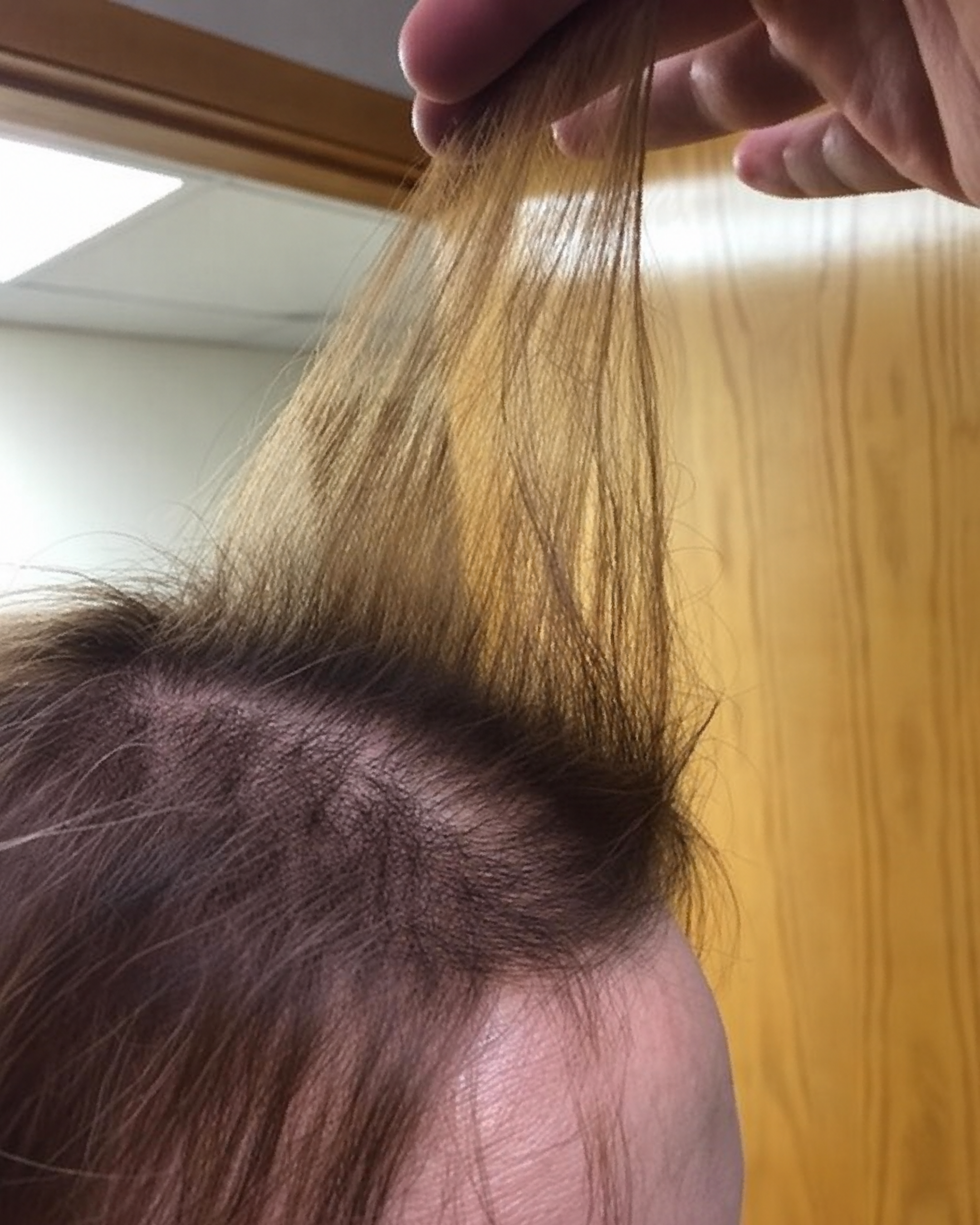 Dr. Patricia Sullivan Facebook ad: The reason why my patient was losing her hair