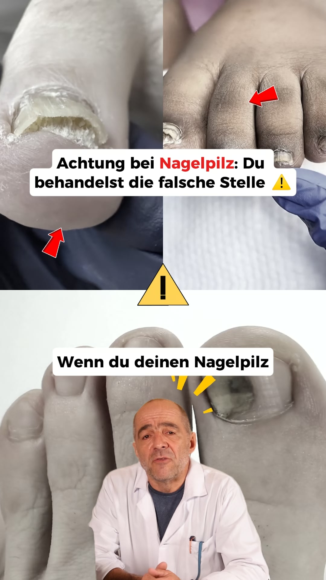 Nagelpilz Ratgeber Facebook ad: Der größte Fehler bei Nagelpilz