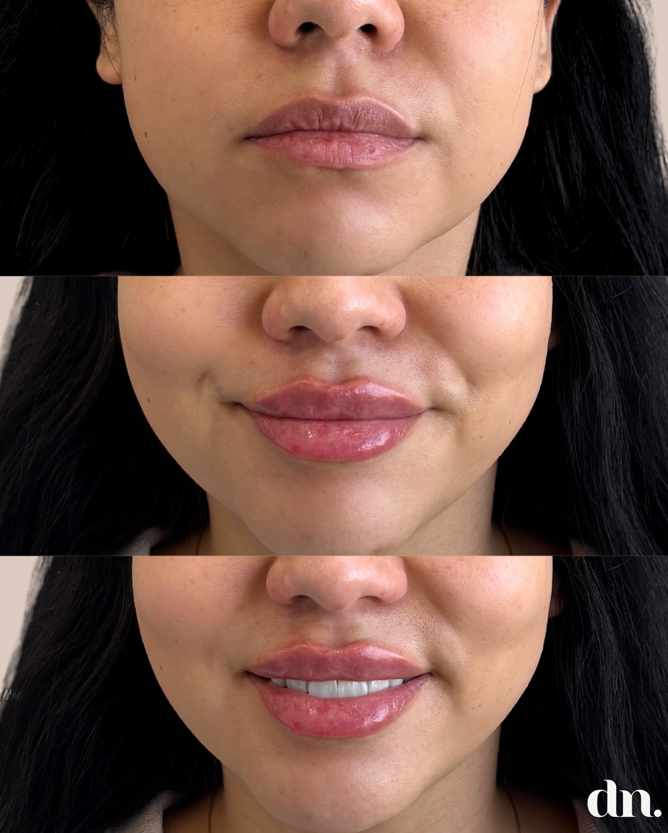 DERMA NOOR Medspa Facebook ad