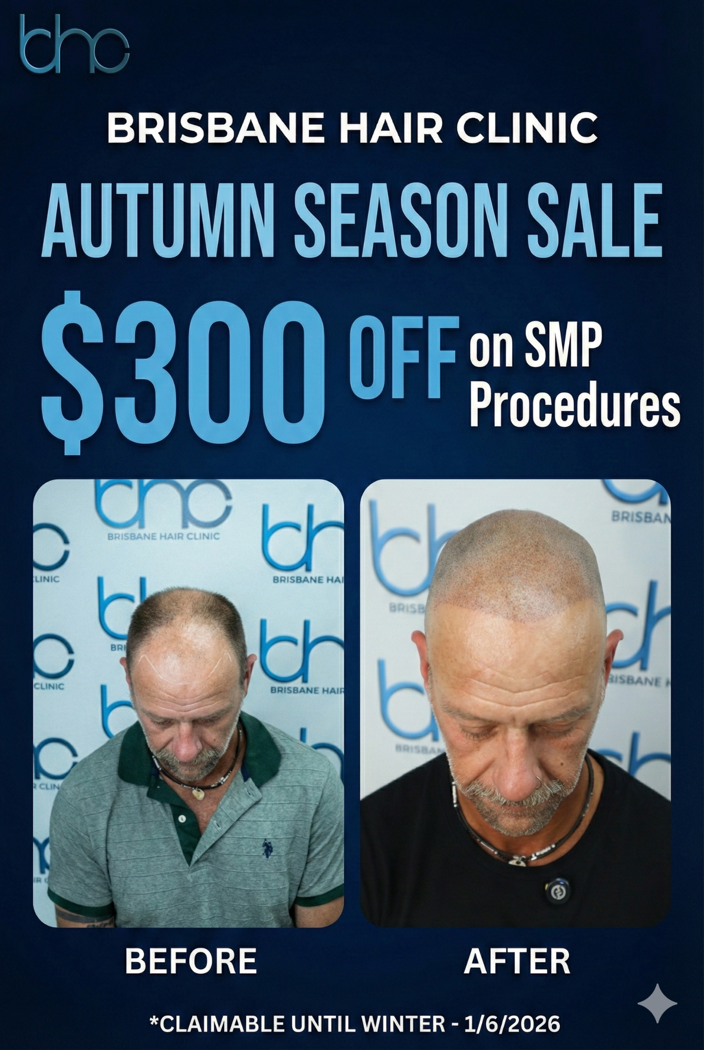 Brisbane Hair Clinic Facebook ad: Confidence Upgrade, Limited Offer