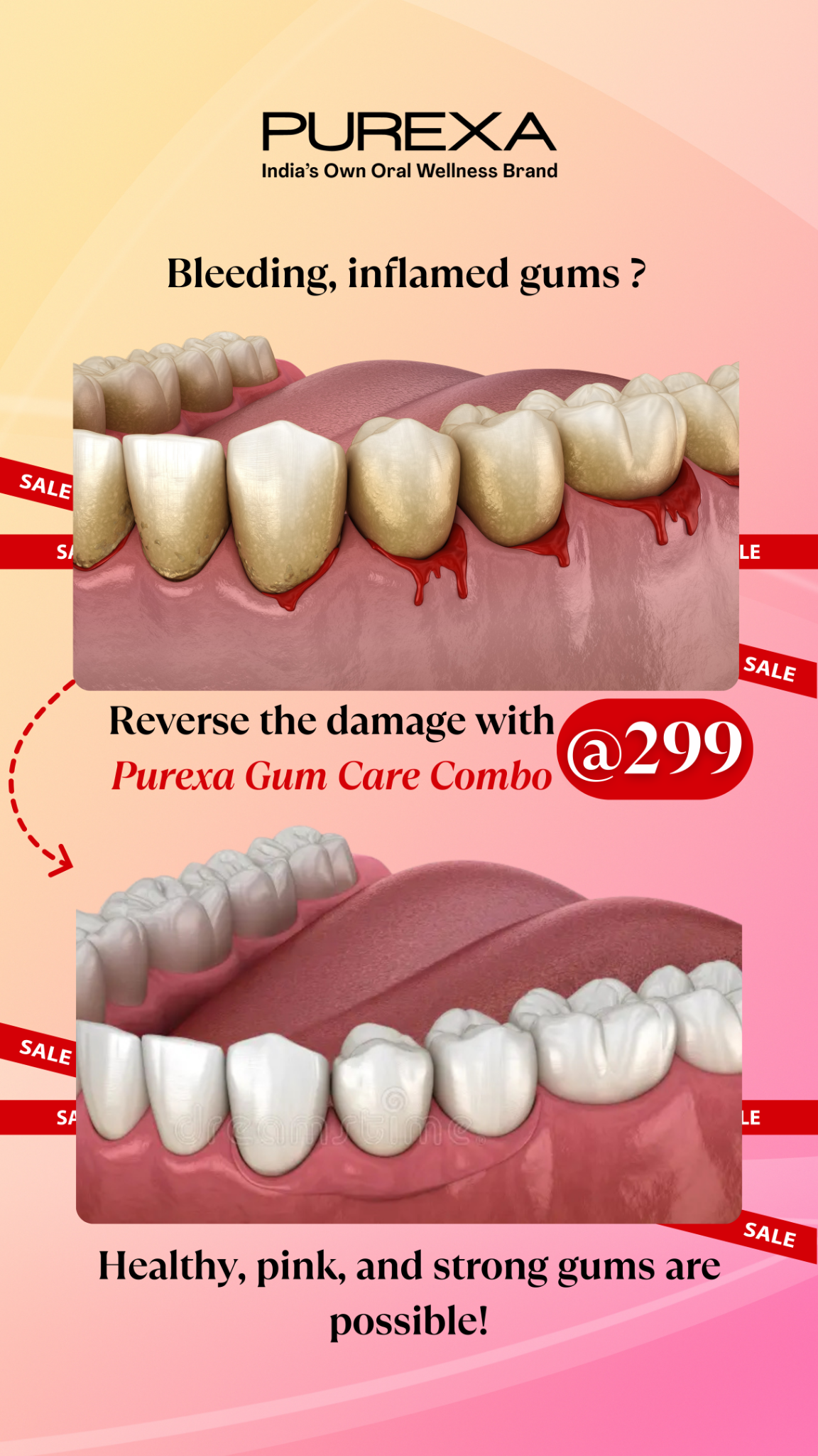 Purexa Facebook ad