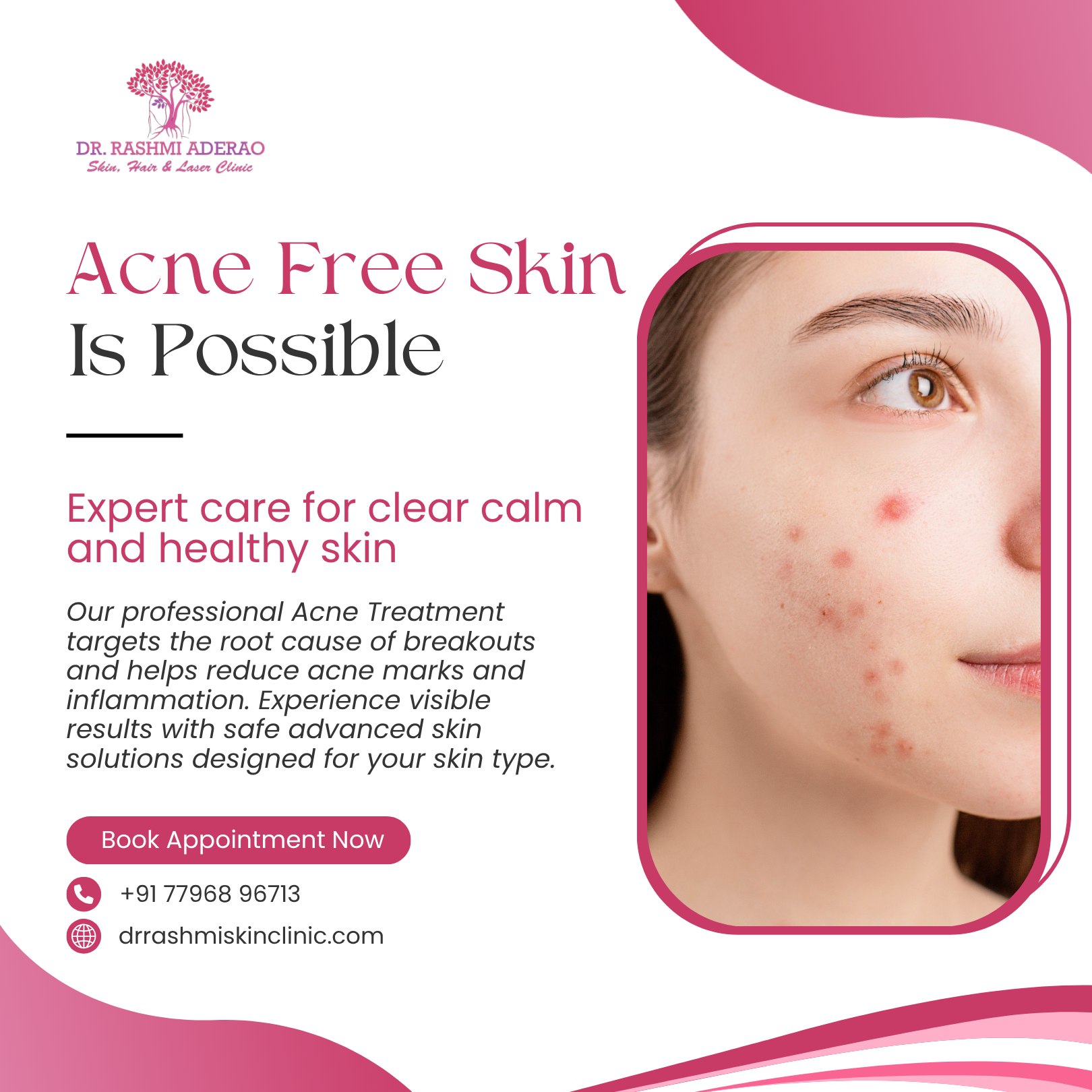 Dr. Rashmi Aderao Skin, Hair & Laser Clinic Facebook ad