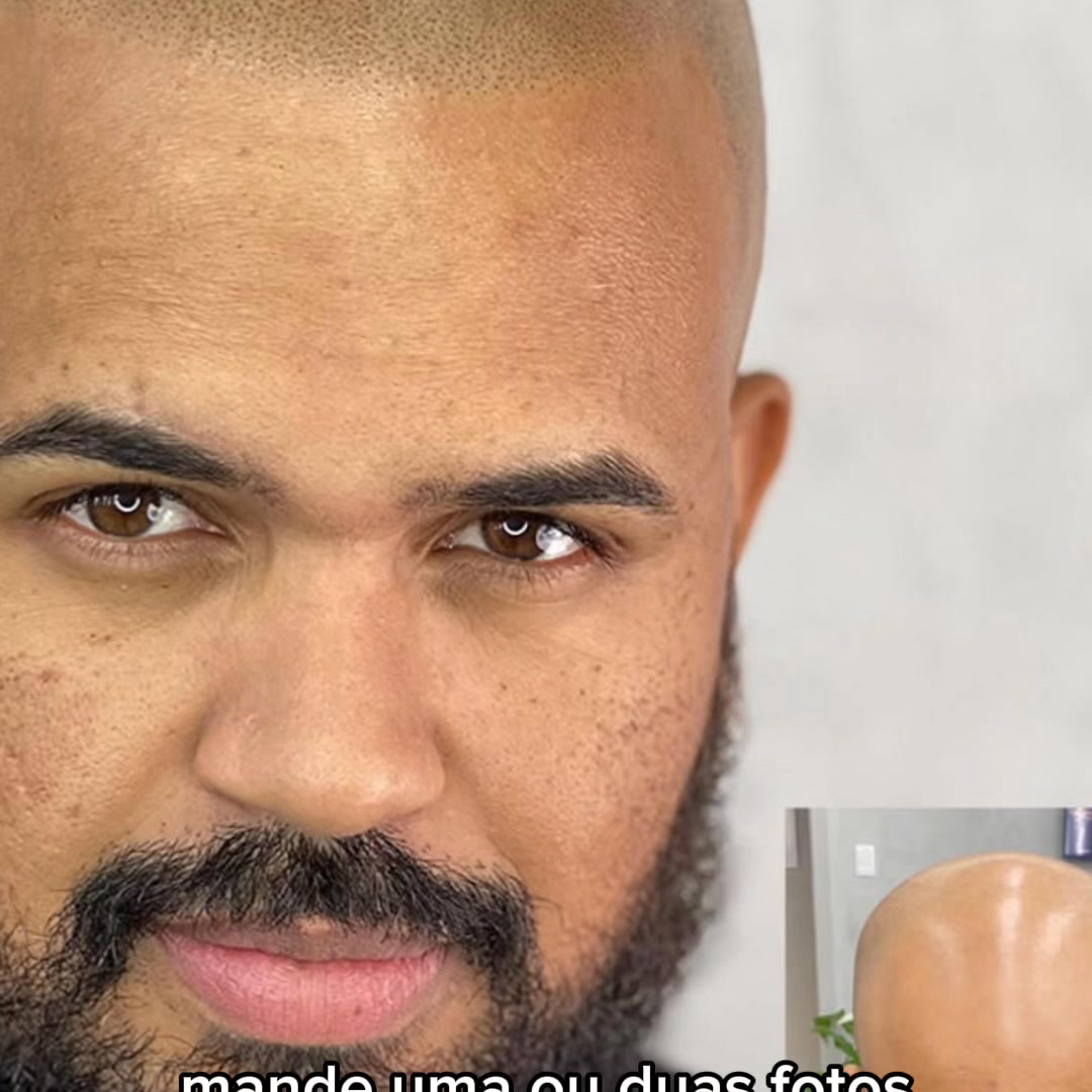 Ton Gois - Especialista em Micropigmentação Capilar Facebook ad