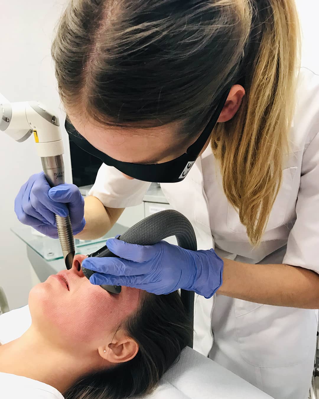 ProClinic Facebook ad: Laserowe usuwanie przebarwień Wrocław | ProClinic
