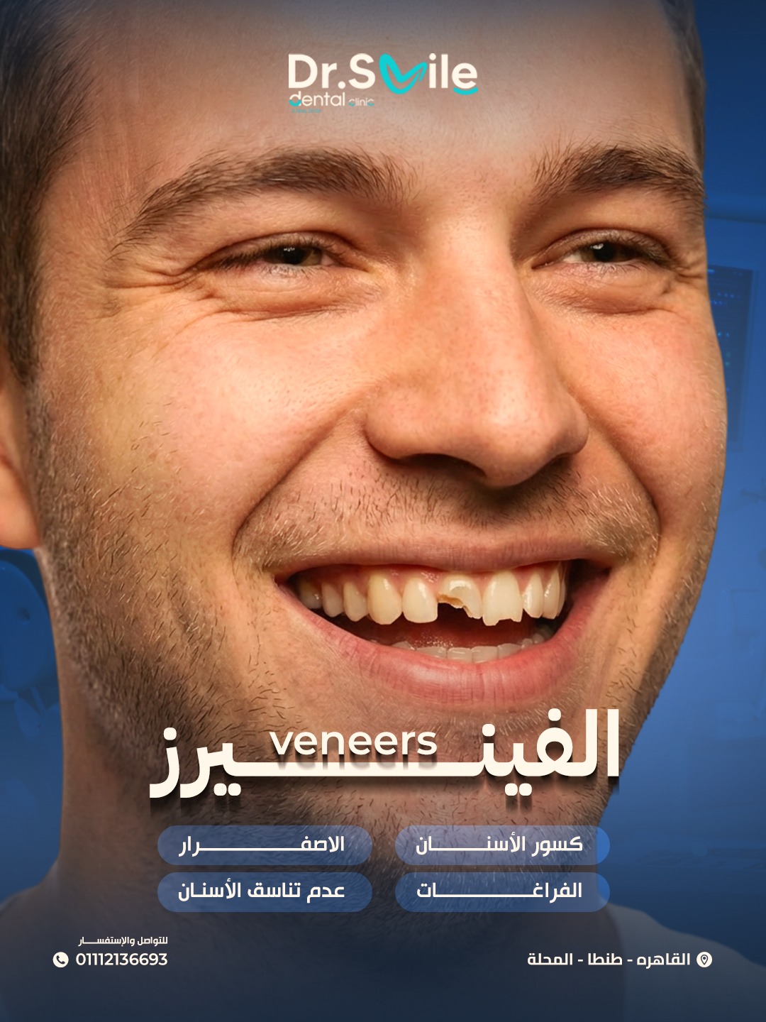 Dr.Smile Dental Clinic - لزراعة وتجميل الأسنان Facebook ad