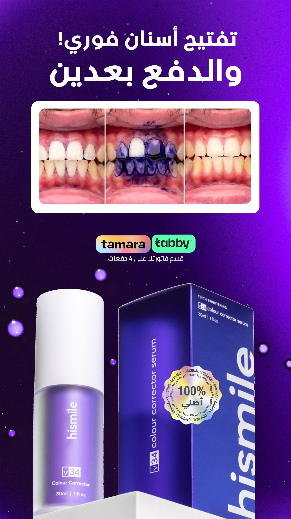 Hismile Teeth Middle East Facebook ad