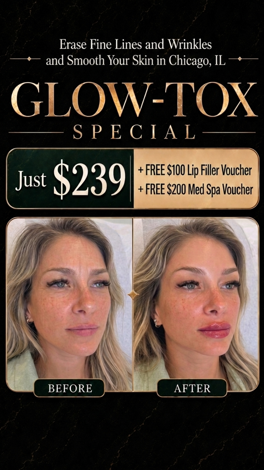 Shaperz Elite Wellness and Aesthetics Facebook ad