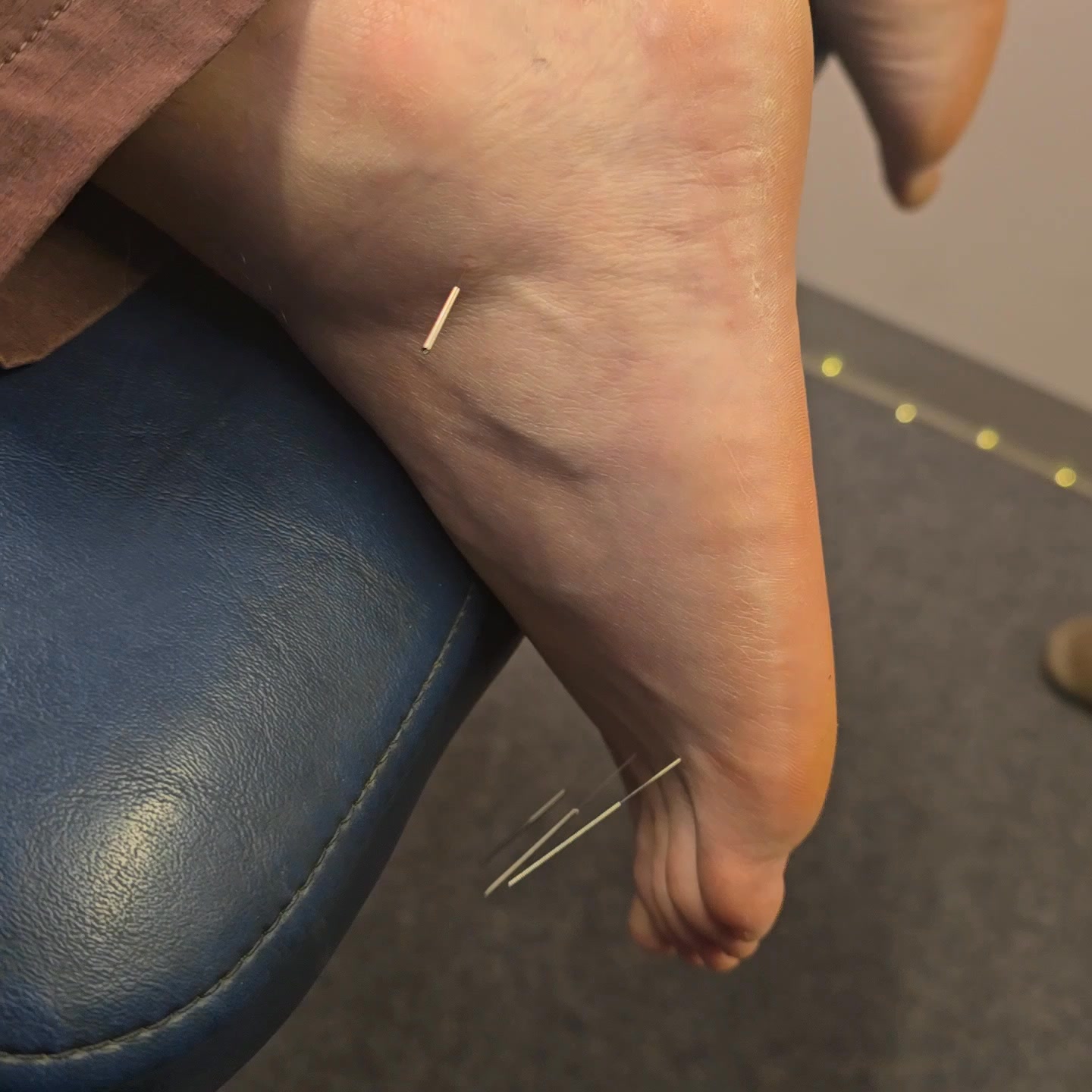 Dow Chiropractic and Acupuncture Facebook ad from Jun 2, 2026