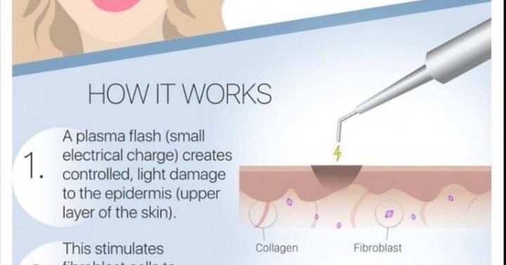 Rockwood Aesthetics at Transformations the Med Spa Facebook ad: Brazilian wax professional, facials, plasma fibroblast…